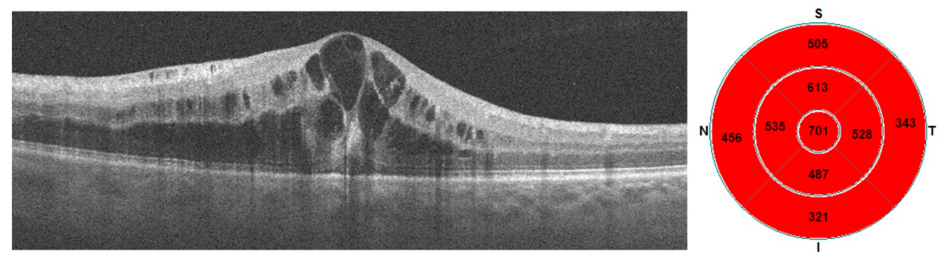 Diagnostics 13 03100 g001