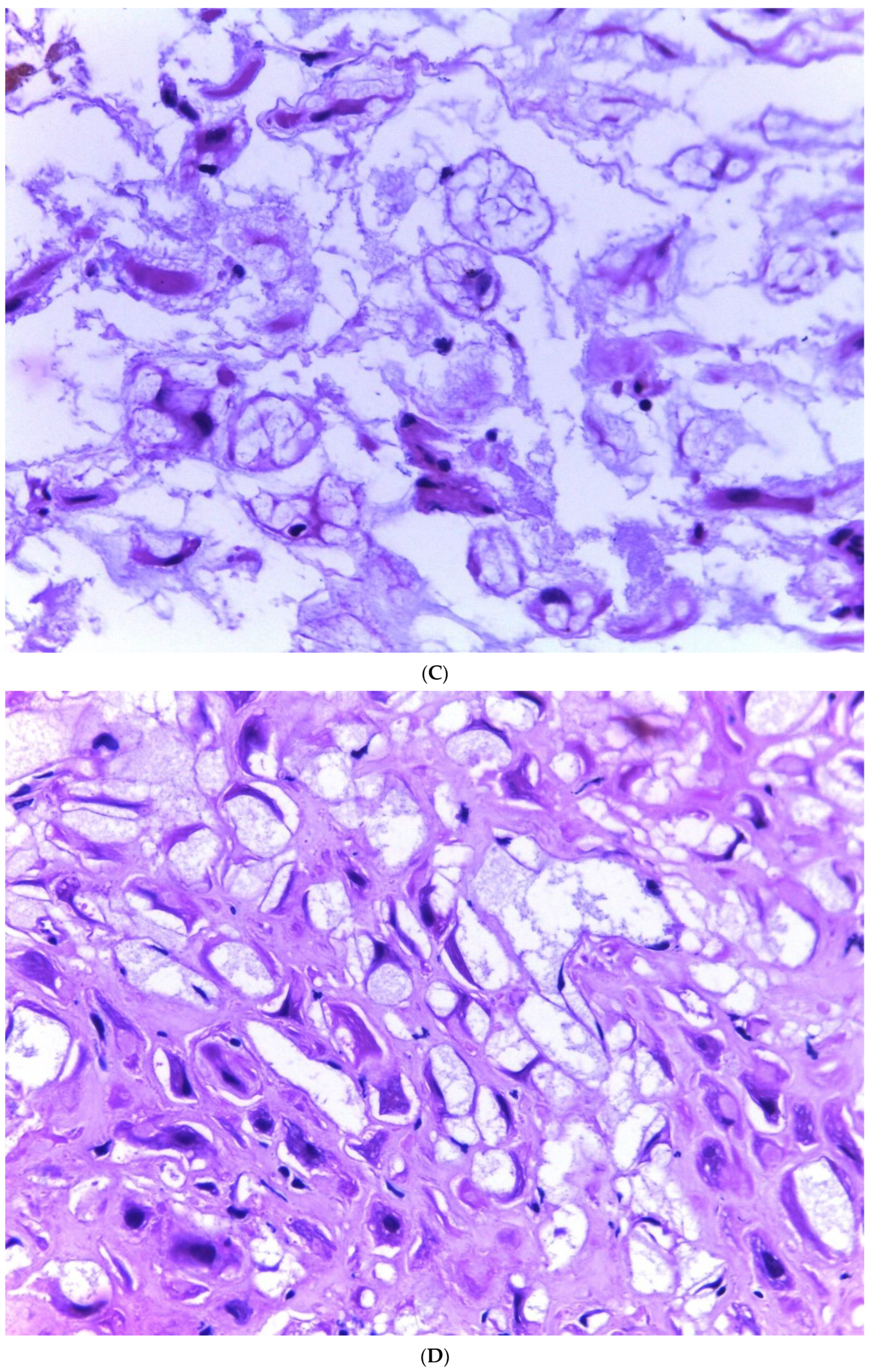 Diagnostics 13 03176 g002b