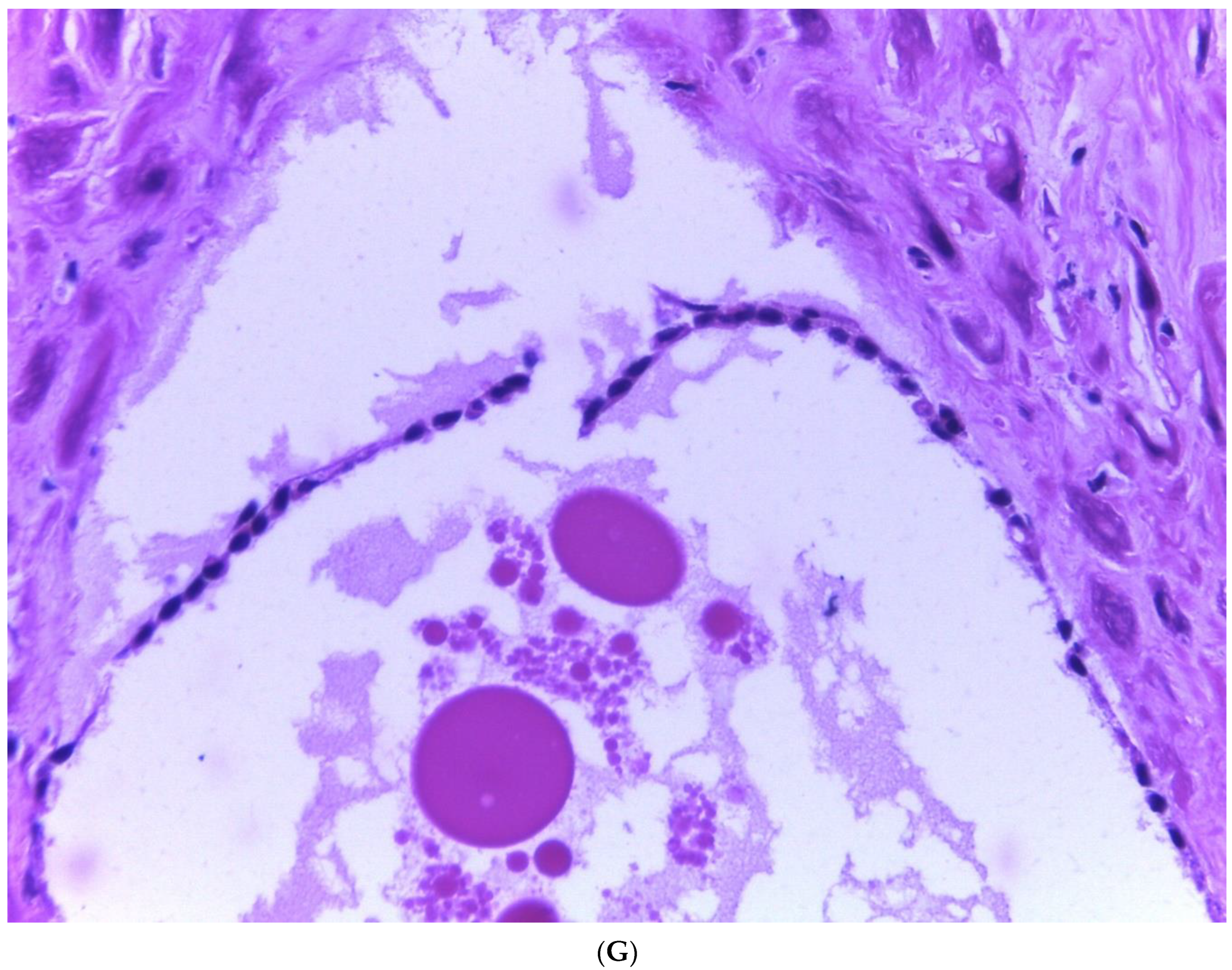 Diagnostics 13 03176 g002d