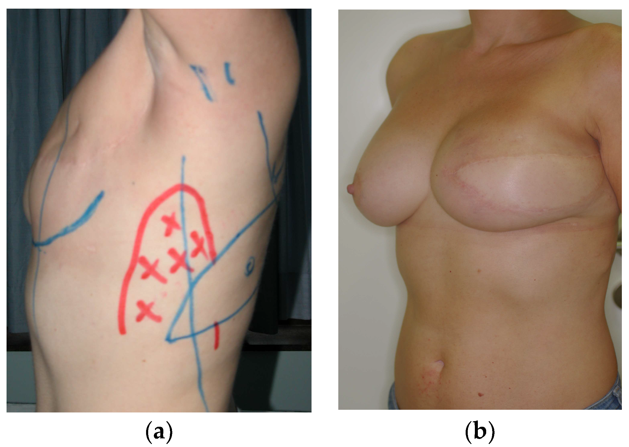 Diagnostics 13 03186 g002
