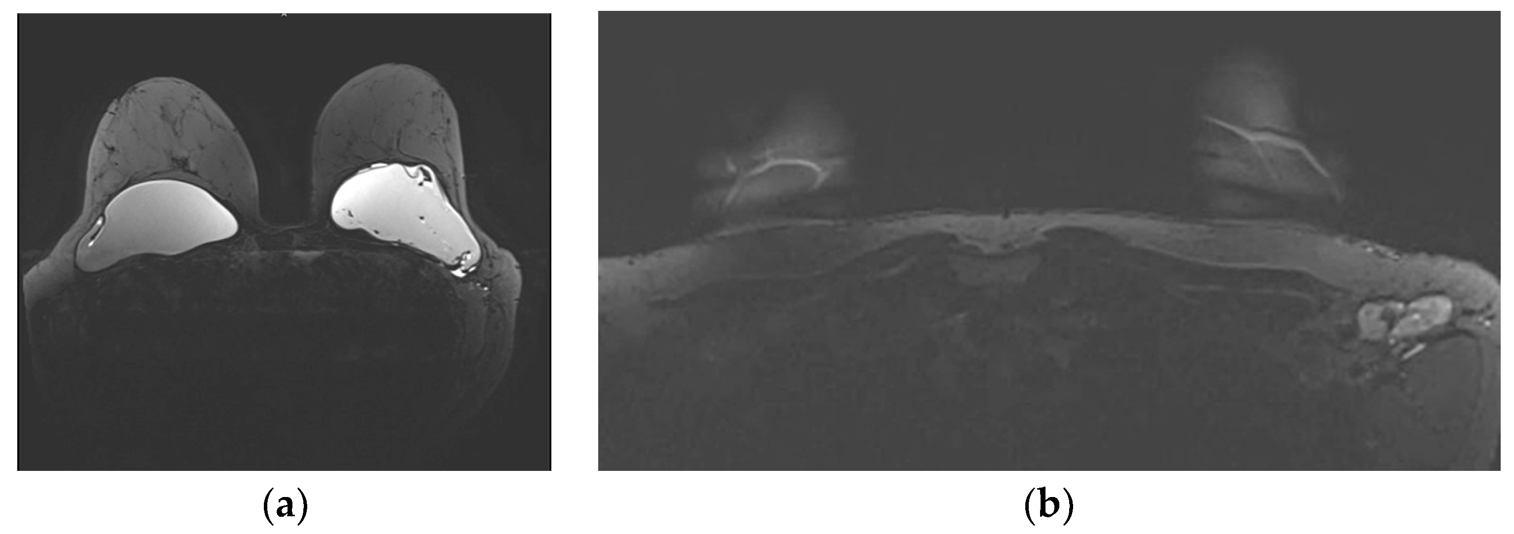 Diagnostics 13 03186 g017