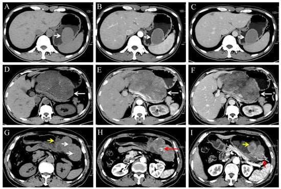 Diagnostics 13 03192 g002