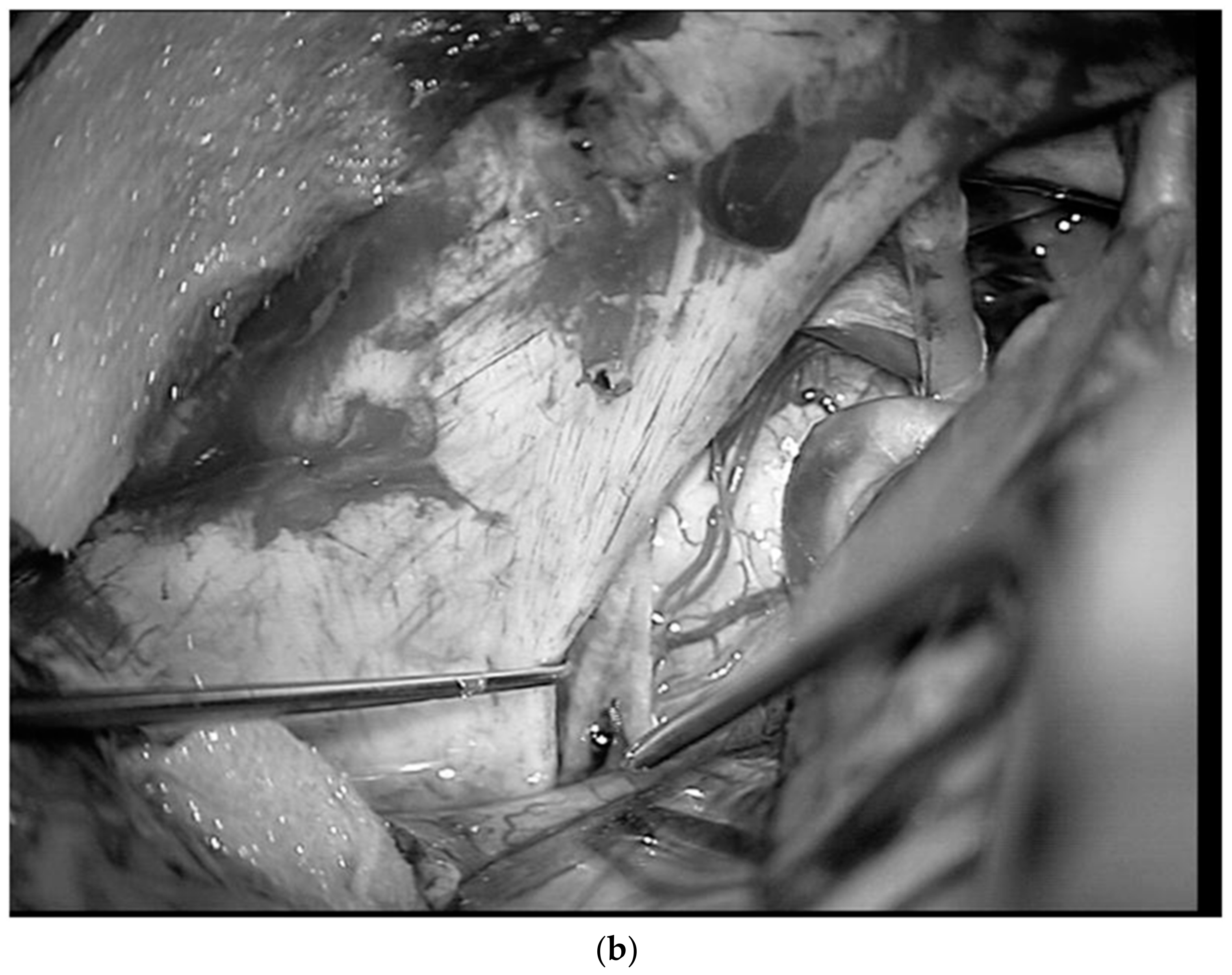 Diagnostics 13 03203 g016b