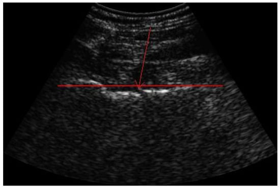 Diagnostics 13 03224 g001