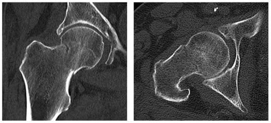 Diagnostics 13 03224 g003