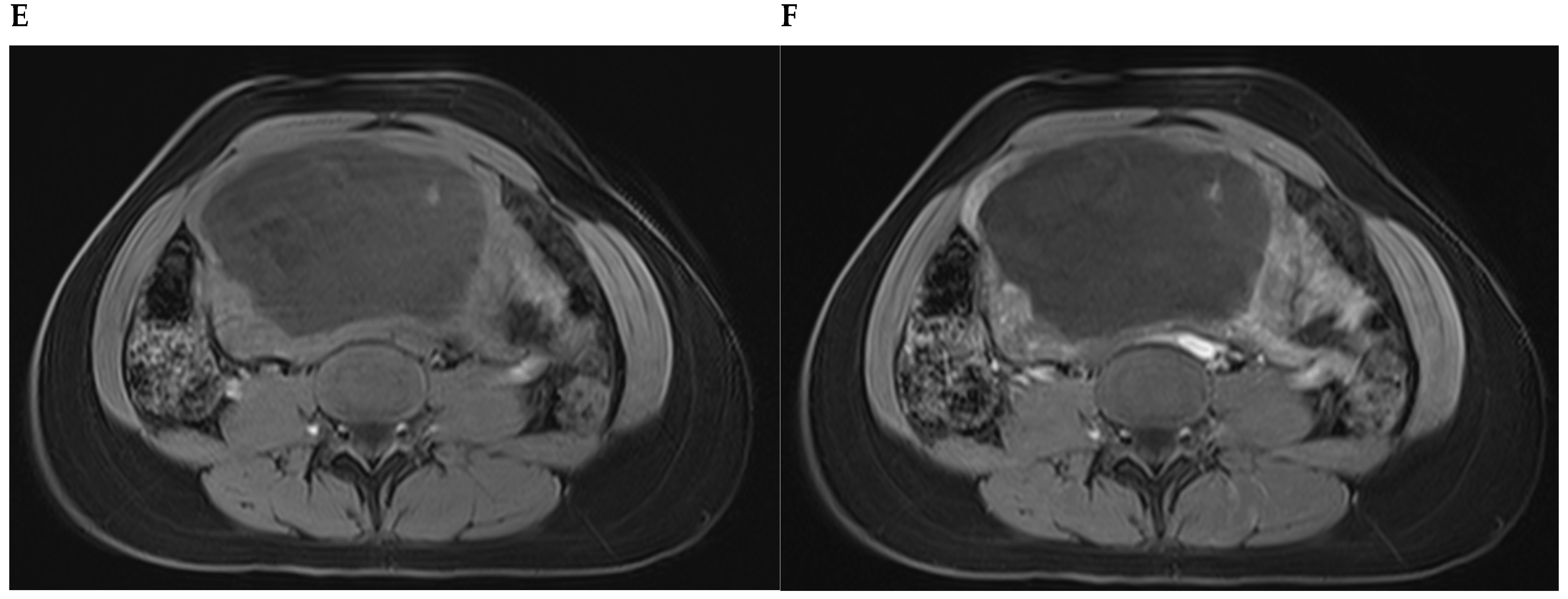 Diagnostics 13 03230 g003b