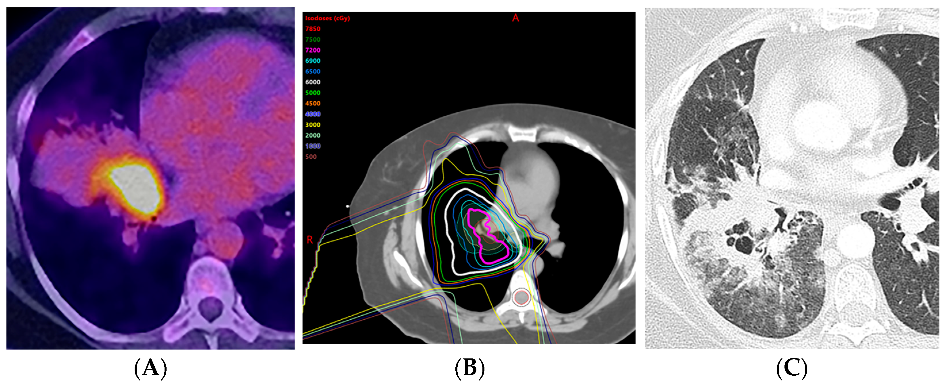 Diagnostics 13 03283 g011