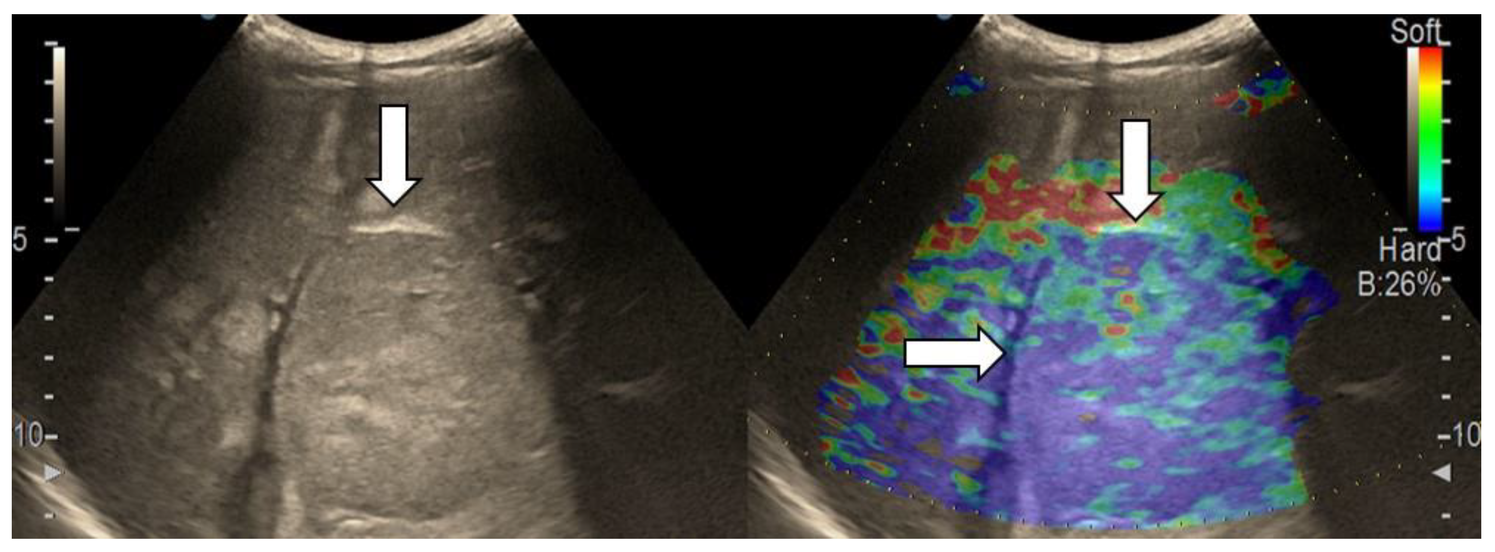 Diagnostics 13 03288 g004