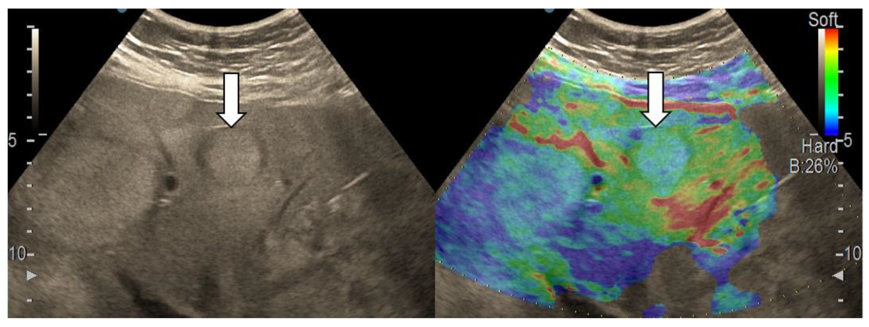 Diagnostics 13 03288 g005