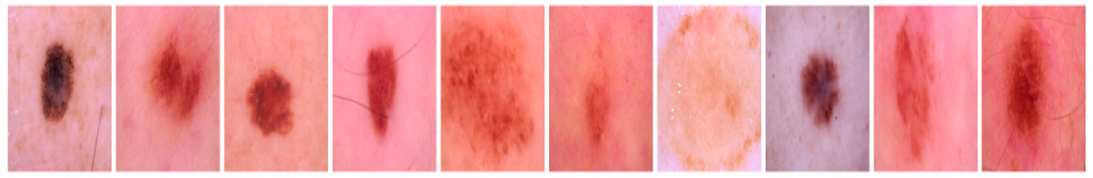 Diagnostics 13 03313 g014