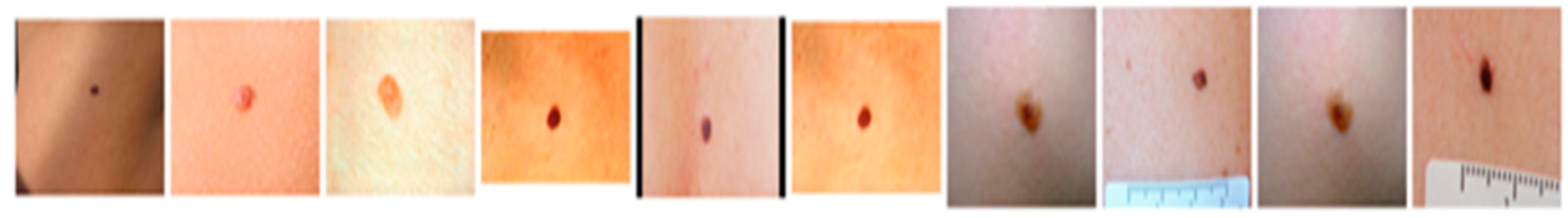 Diagnostics 13 03313 g015