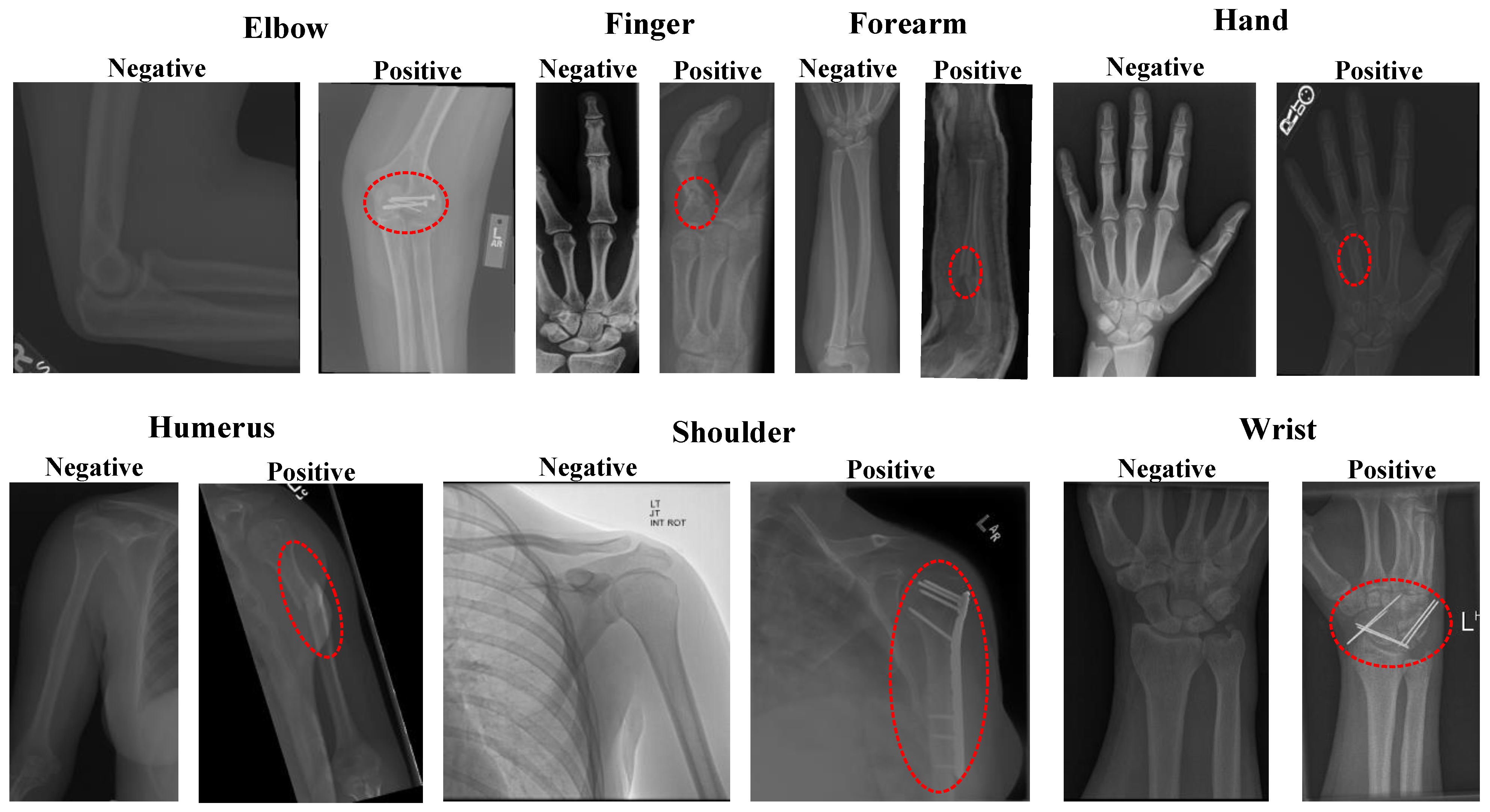 Diagnostics 13 03317 g001