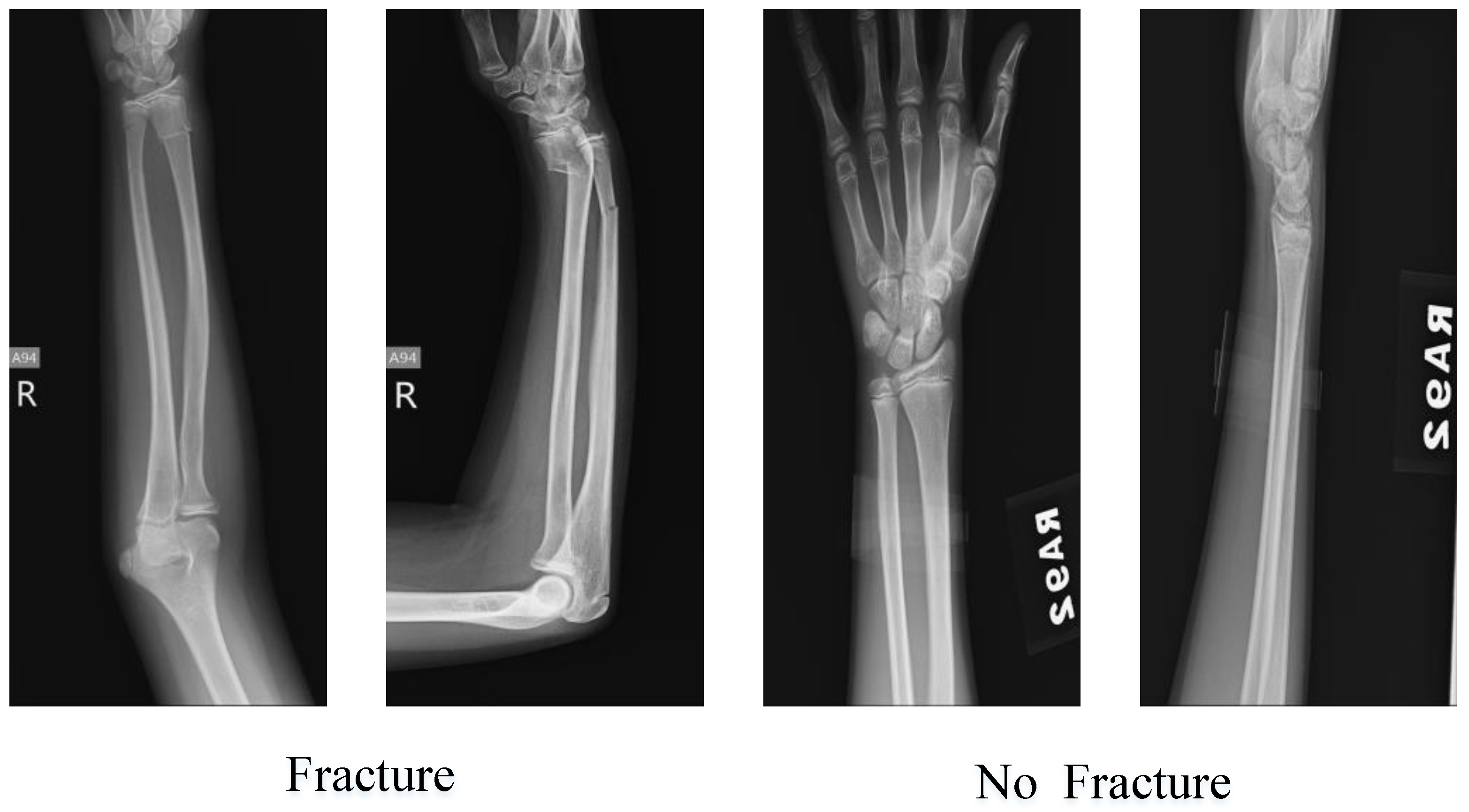 Diagnostics 13 03317 g010