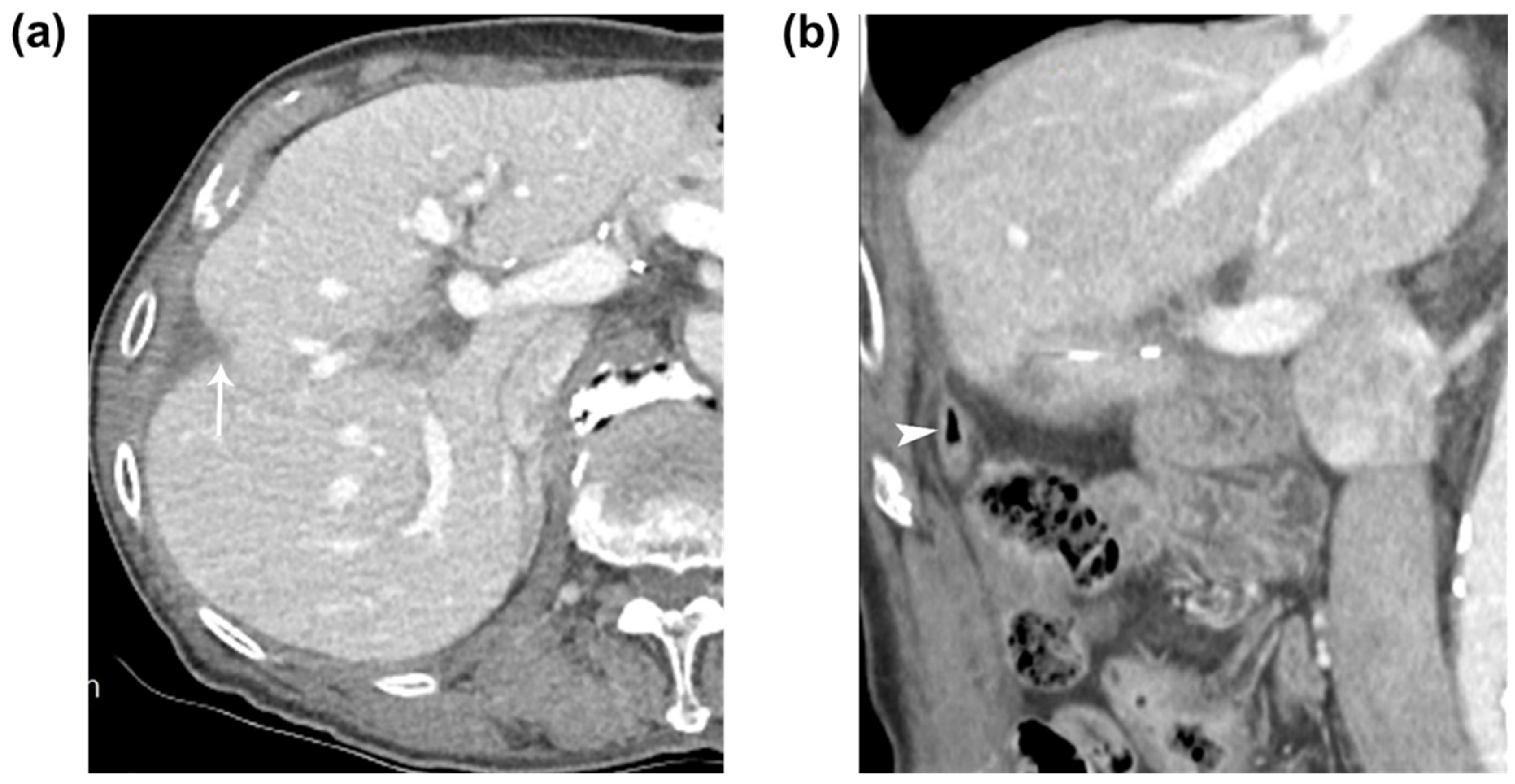 Diagnostics 13 03322 g003