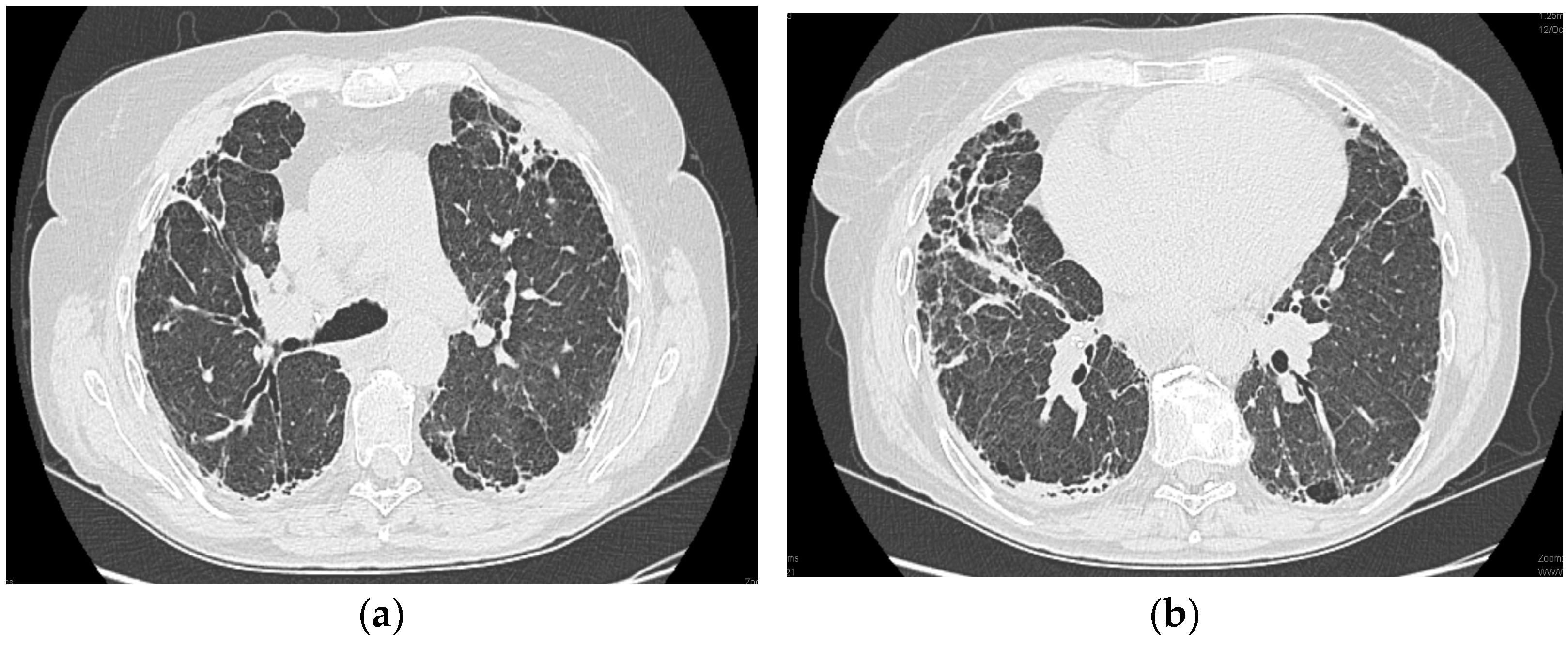 Diagnostics 13 03332 g002