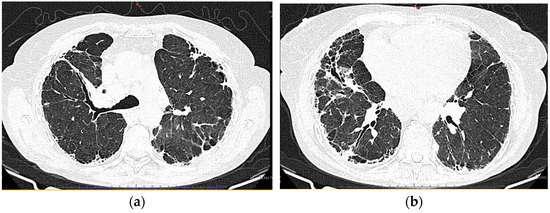 Diagnostics 13 03332 g003