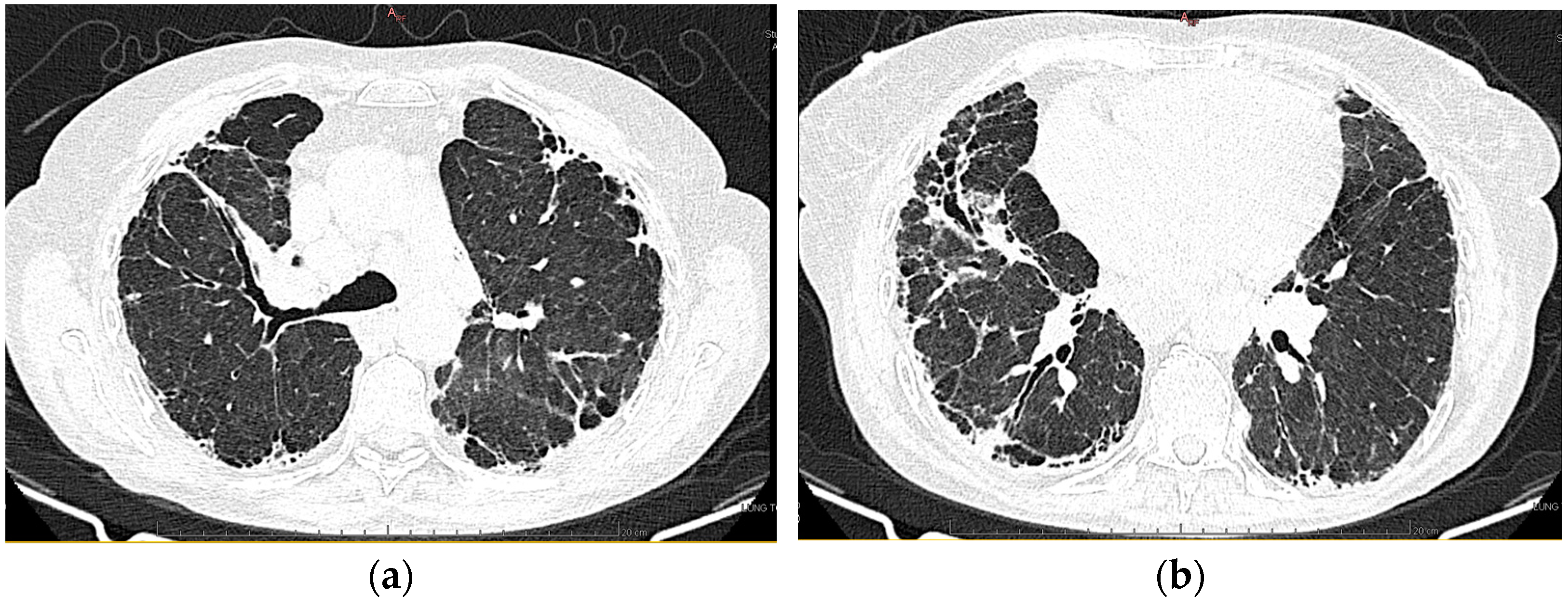 Diagnostics 13 03332 g003