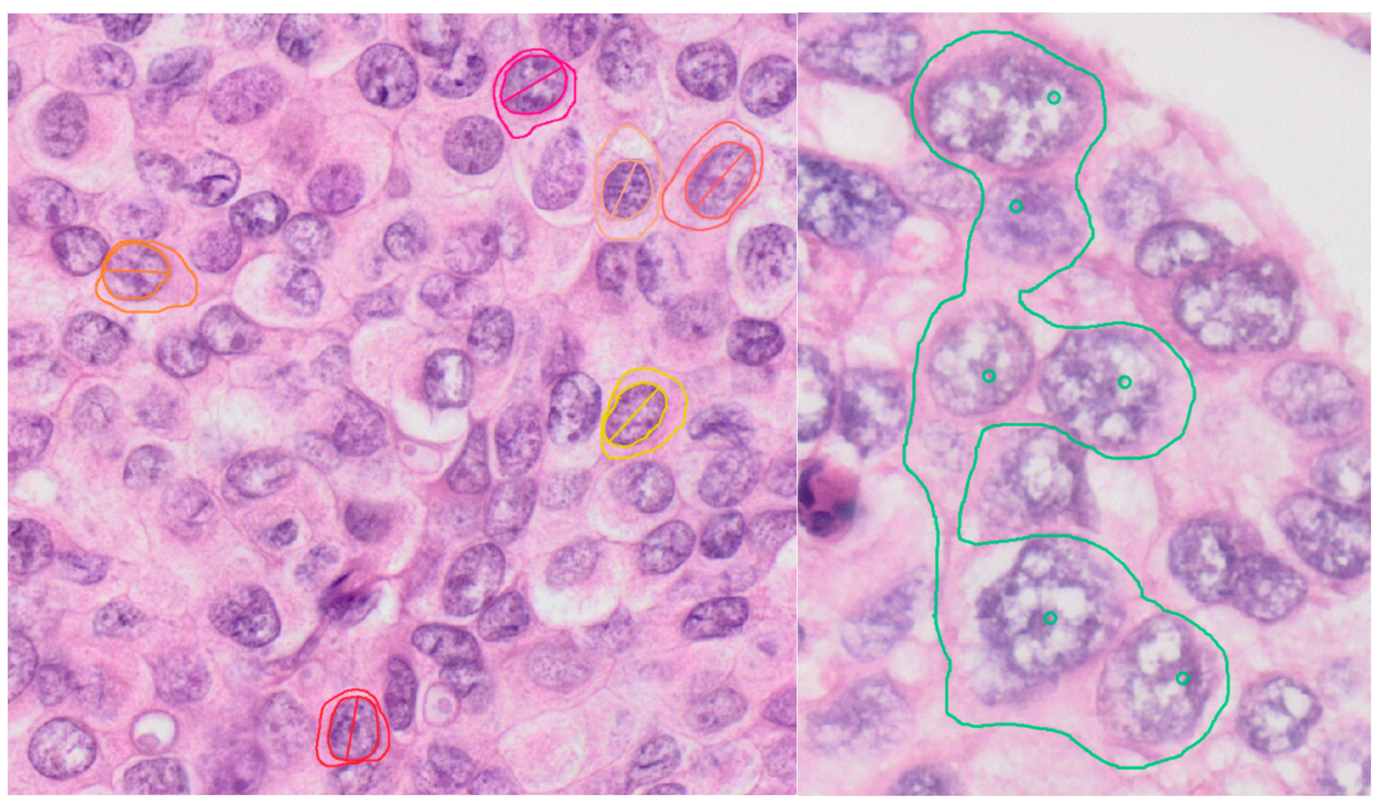 Diagnostics 13 03338 g002