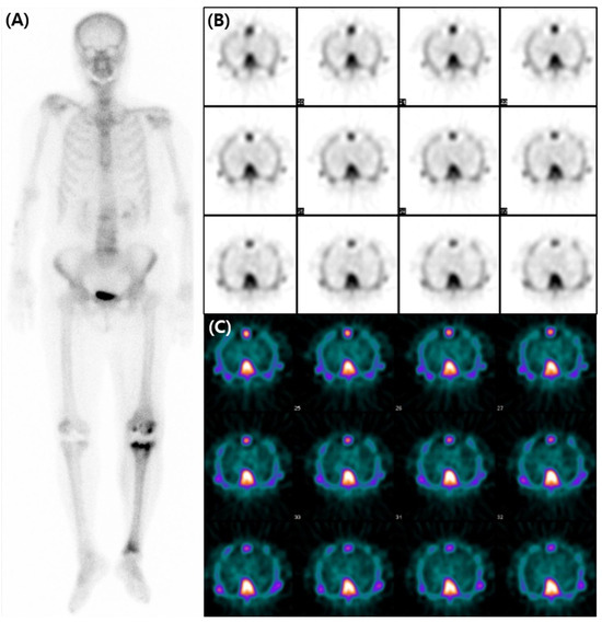 Diagnostics 13 03342 g002