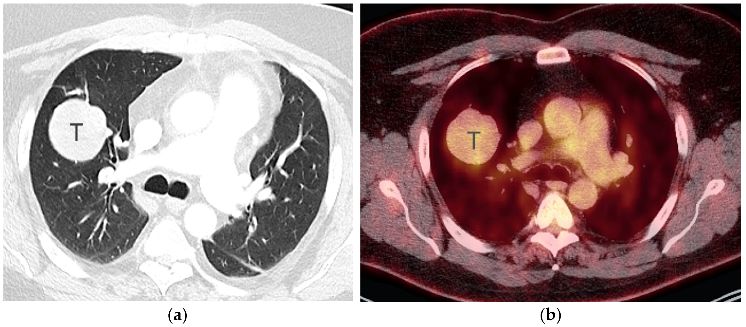 Diagnostics 13 03359 g005