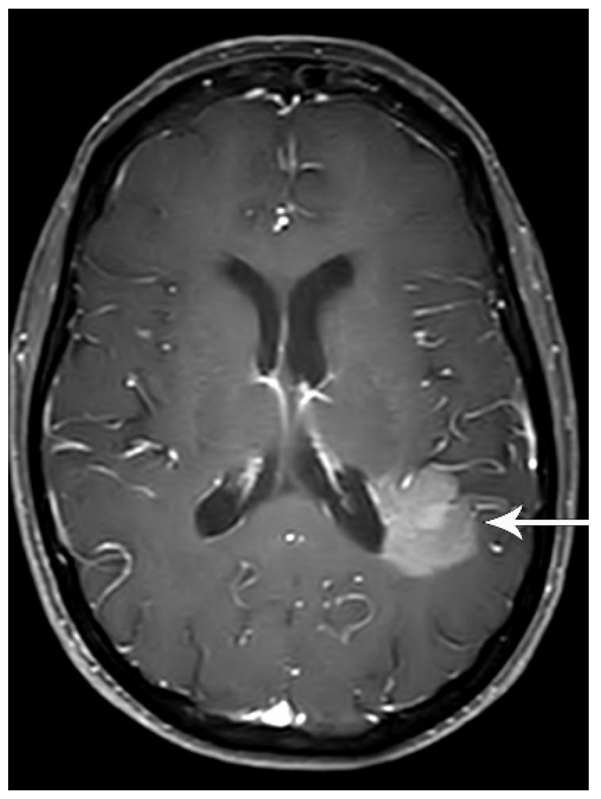 Diagnostics 13 03359 g011