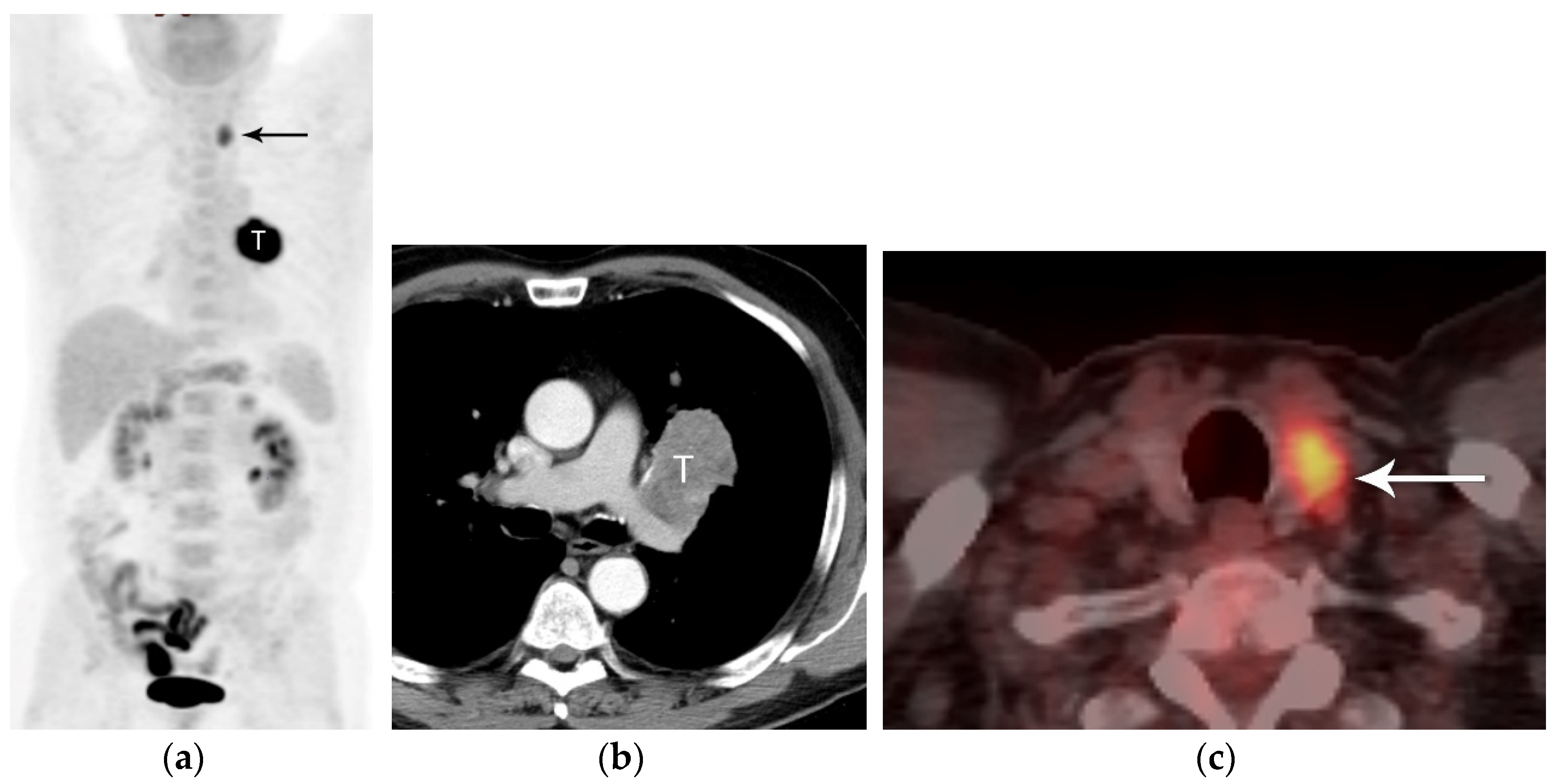 Diagnostics 13 03359 g014