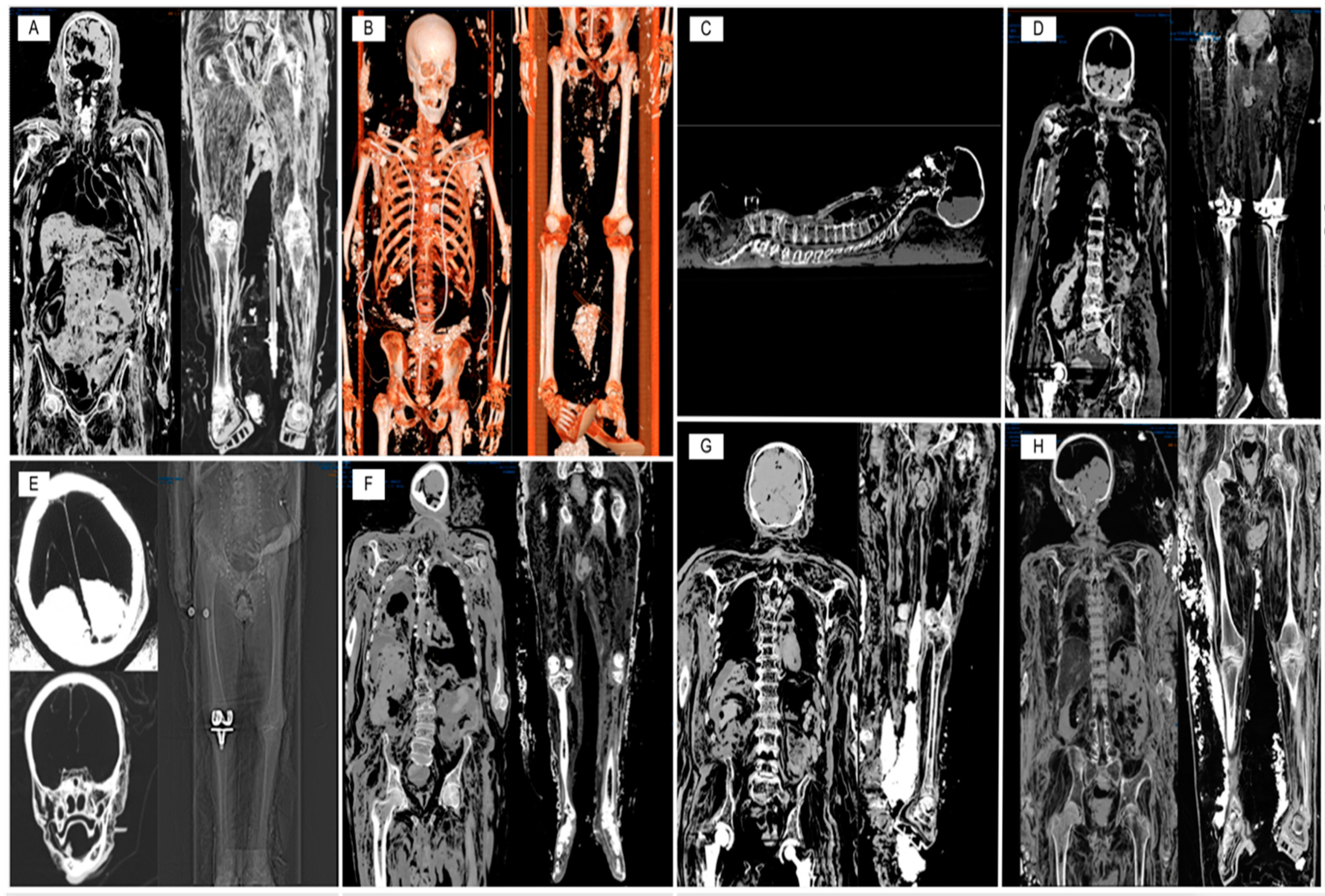Diagnostics 13 03361 g001