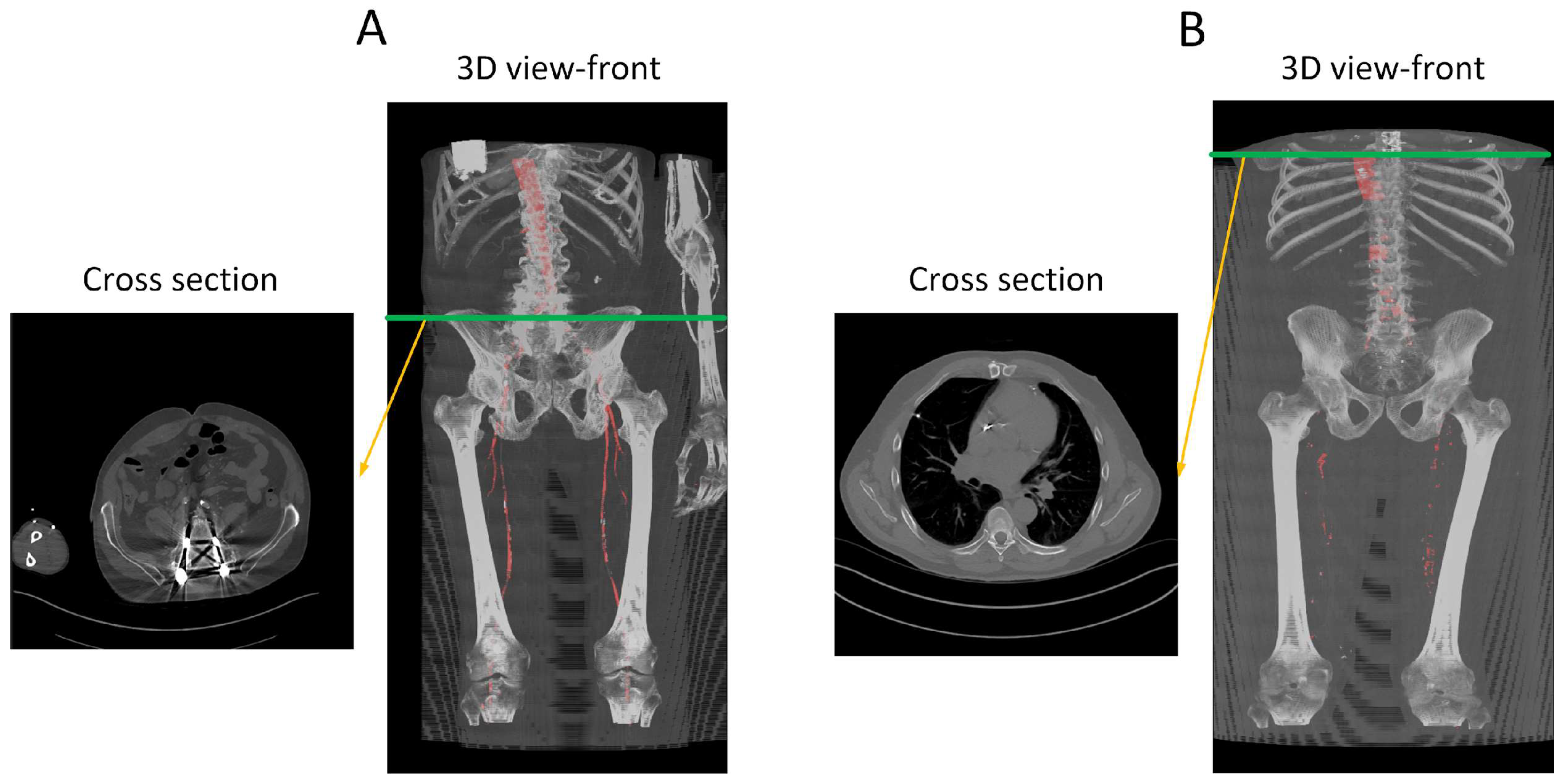 Diagnostics 13 03363 g012