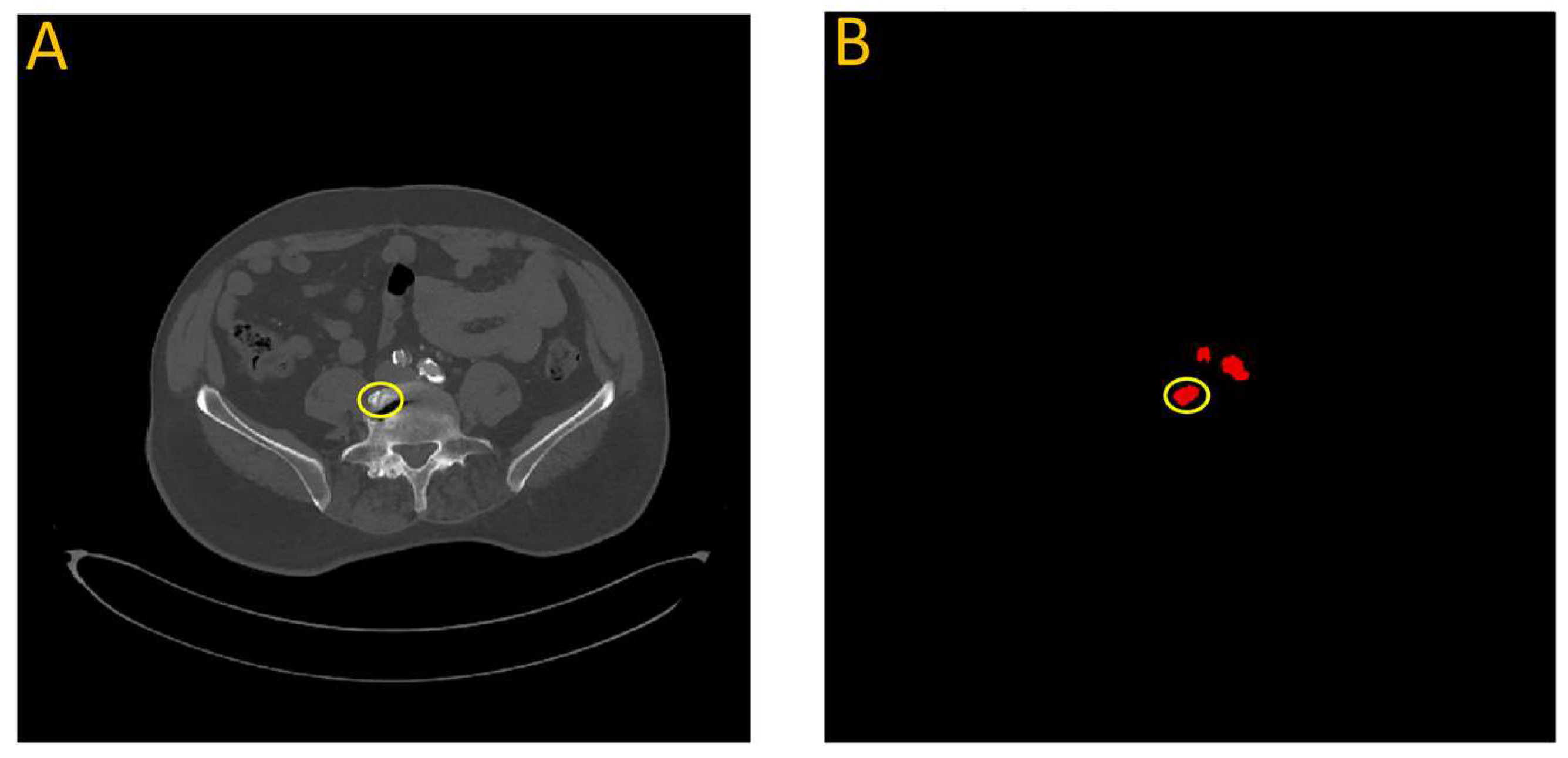 Diagnostics 13 03363 g014