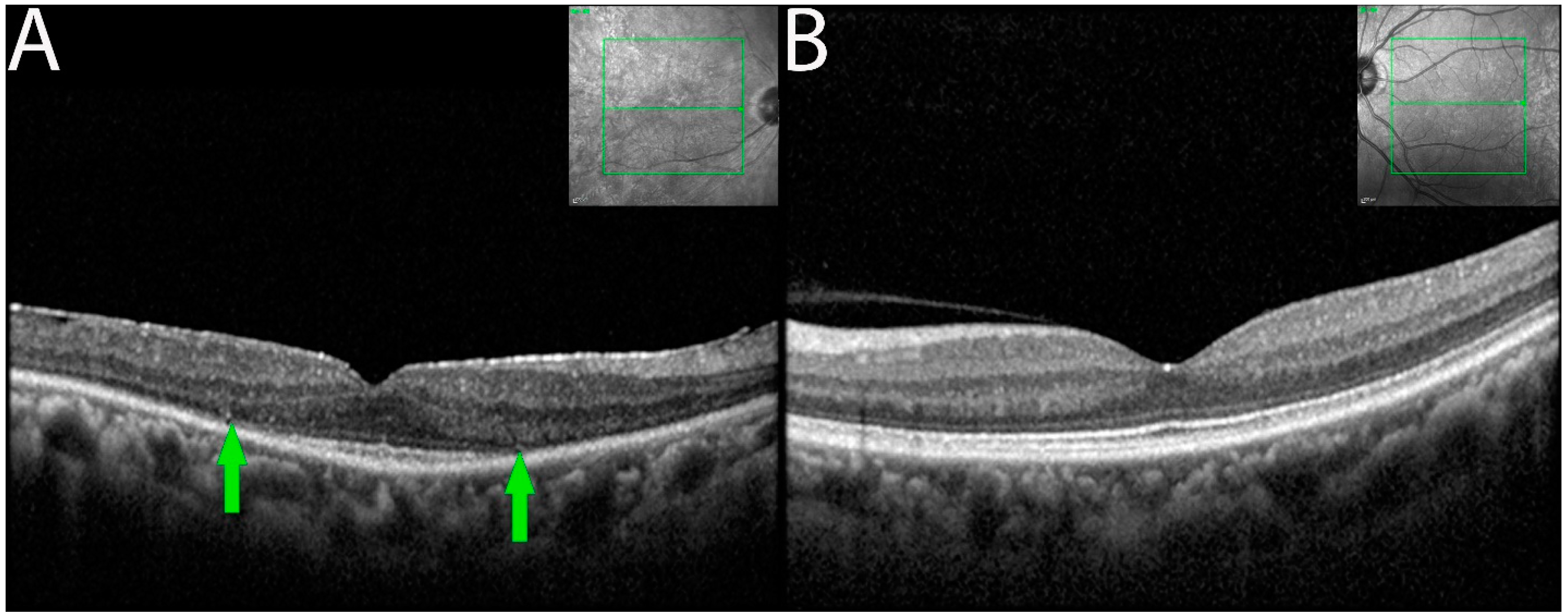 Diagnostics 13 03376 g003