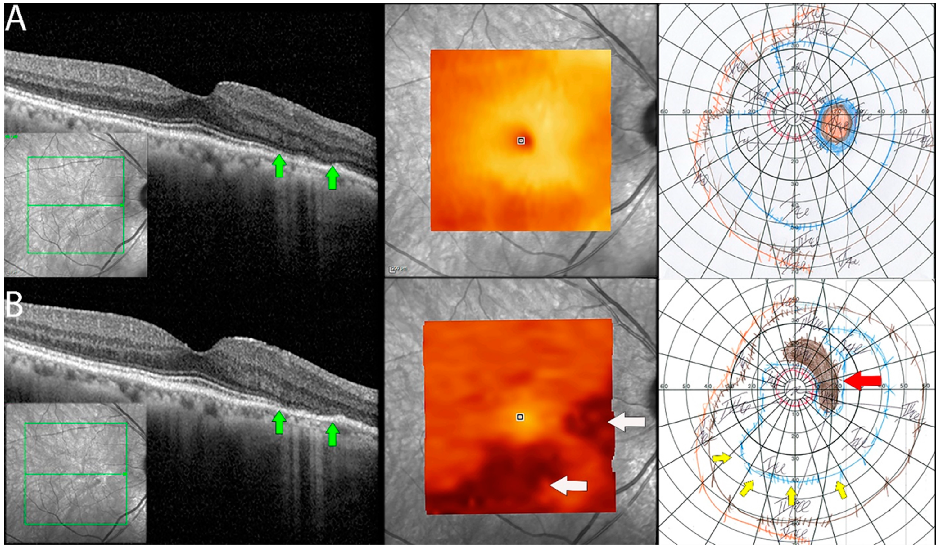Diagnostics 13 03376 g005