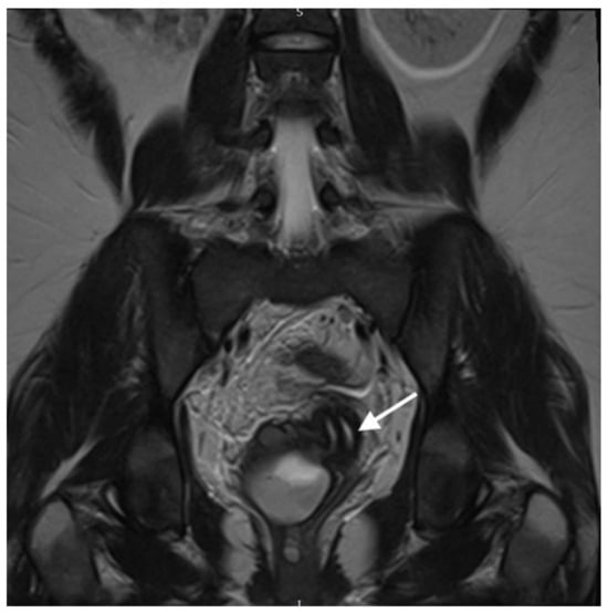 Diagnostics 13 03377 g003