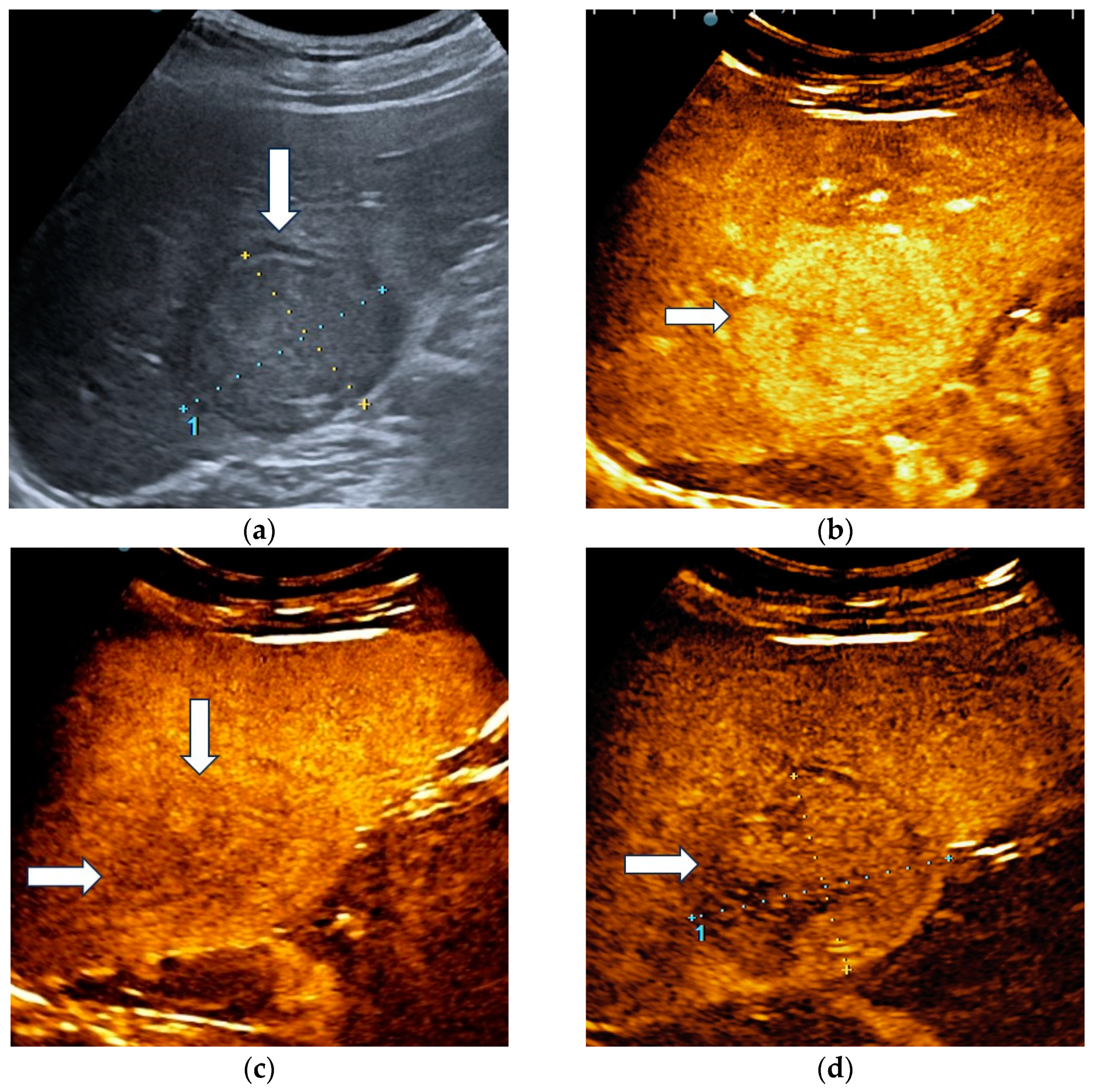 Diagnostics 13 03387 g004