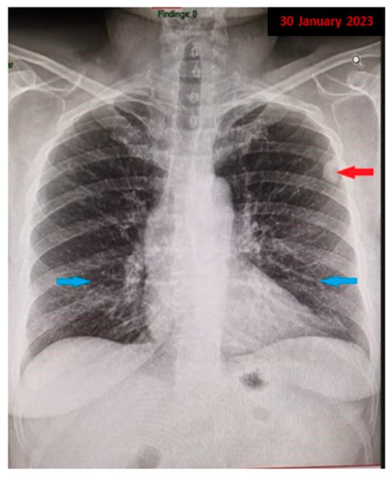 Diagnostics 13 03411 g001