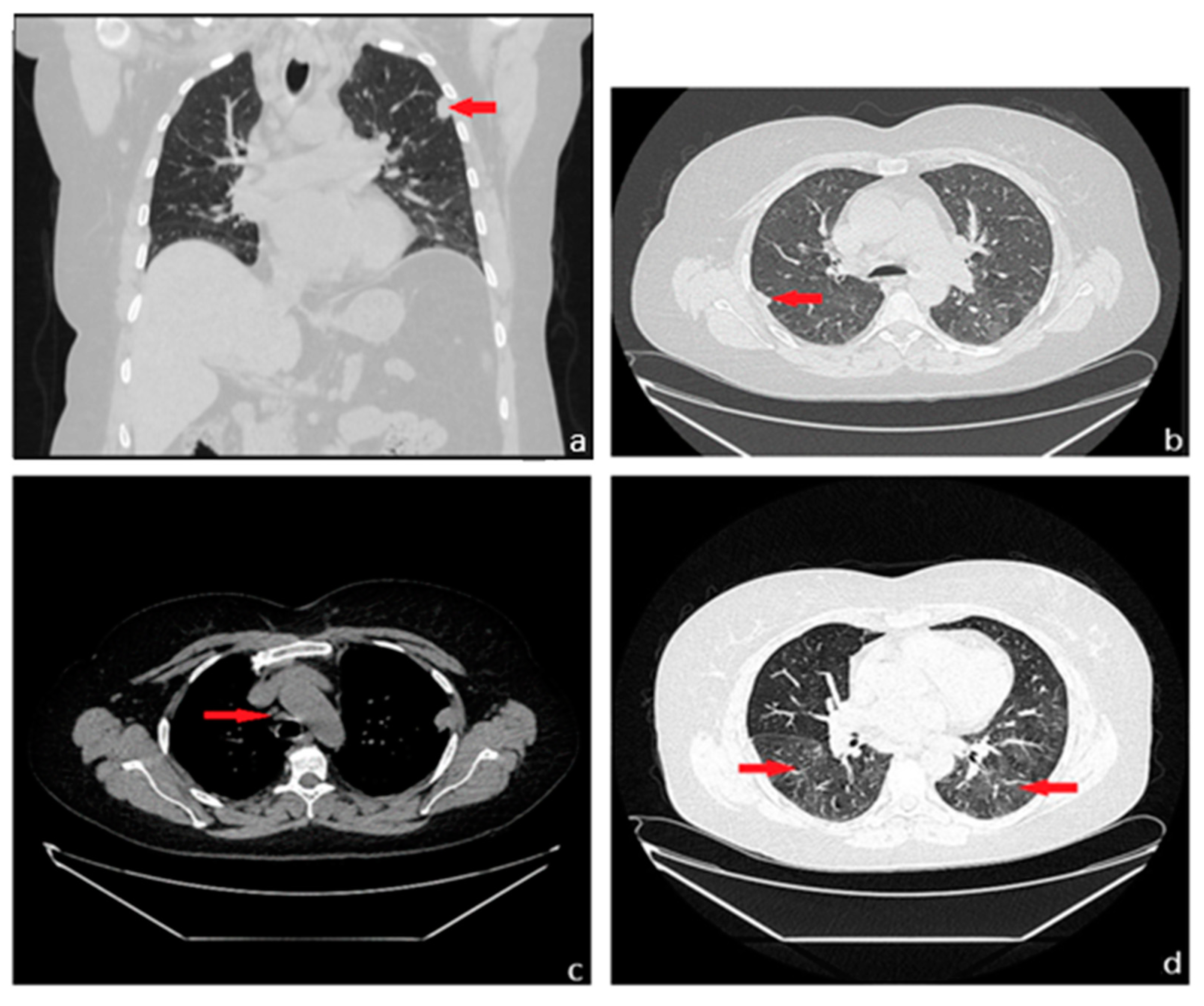 Diagnostics 13 03411 g002 Diagnostics 13 03411 g002