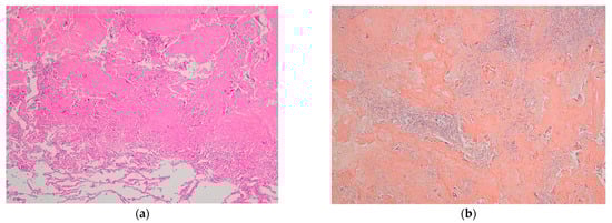 Diagnostics 13 03411 g003