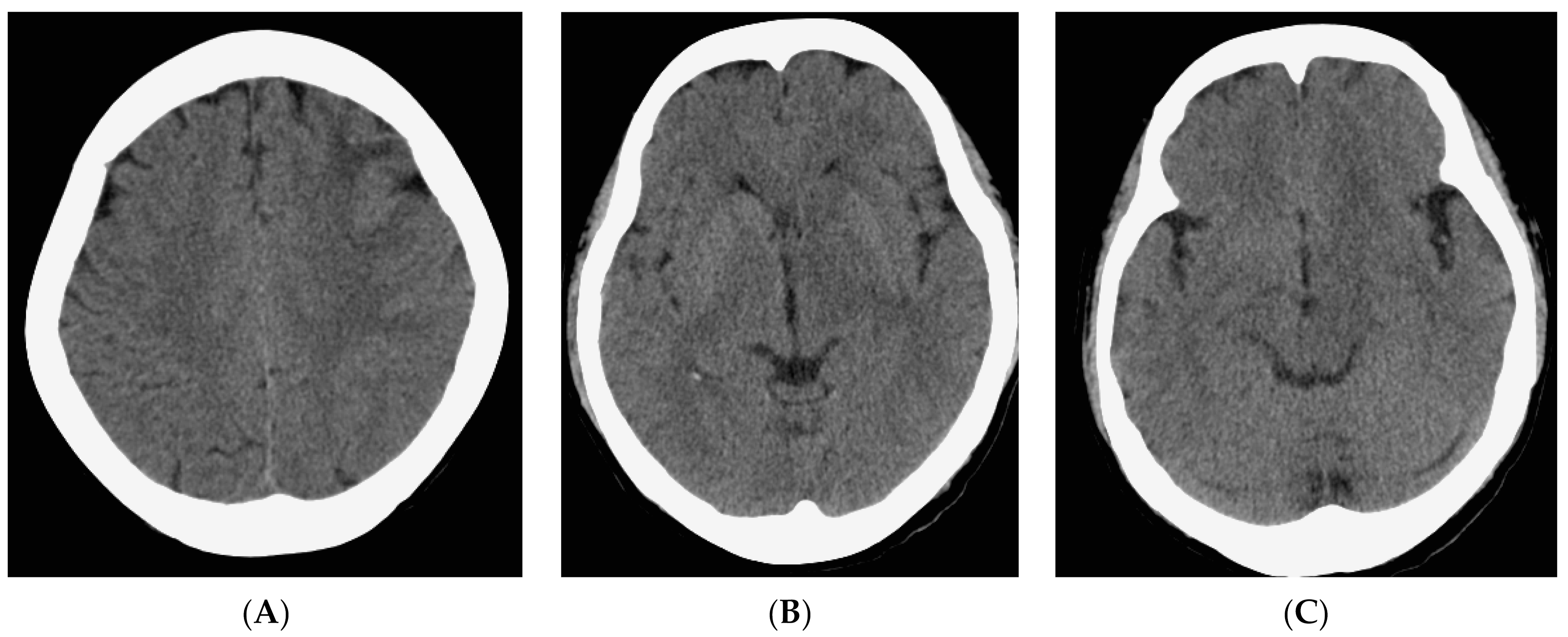 Diagnostics 13 03424 g001