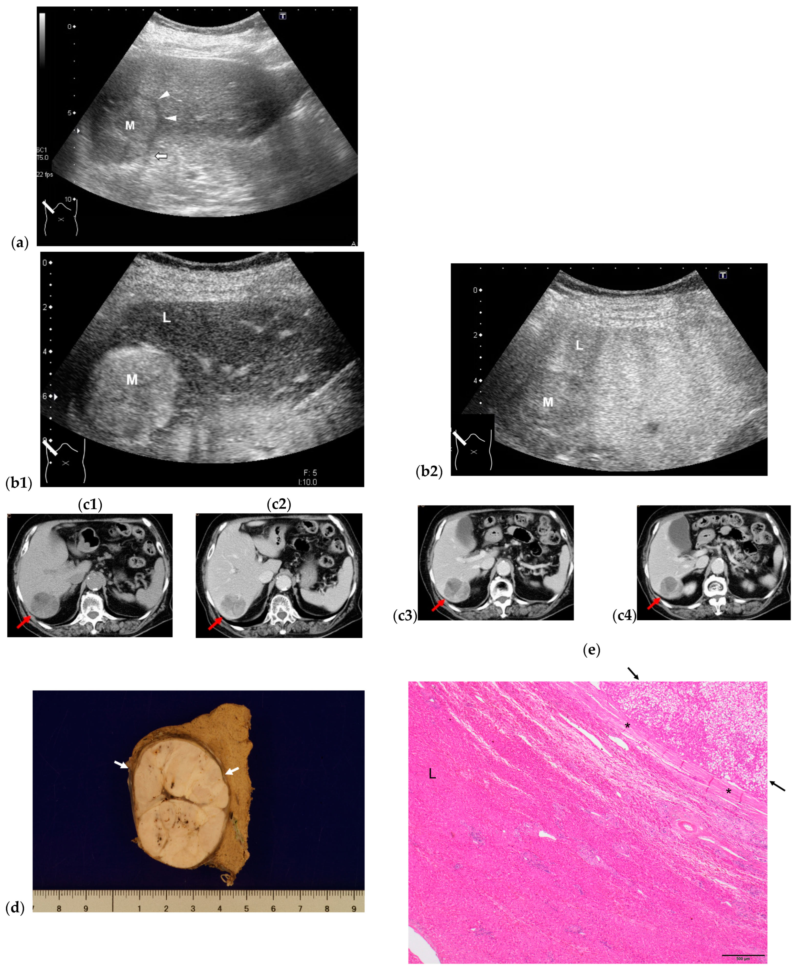 Diagnostics 13 03426 g003 Diagnostics 13 03426 g003