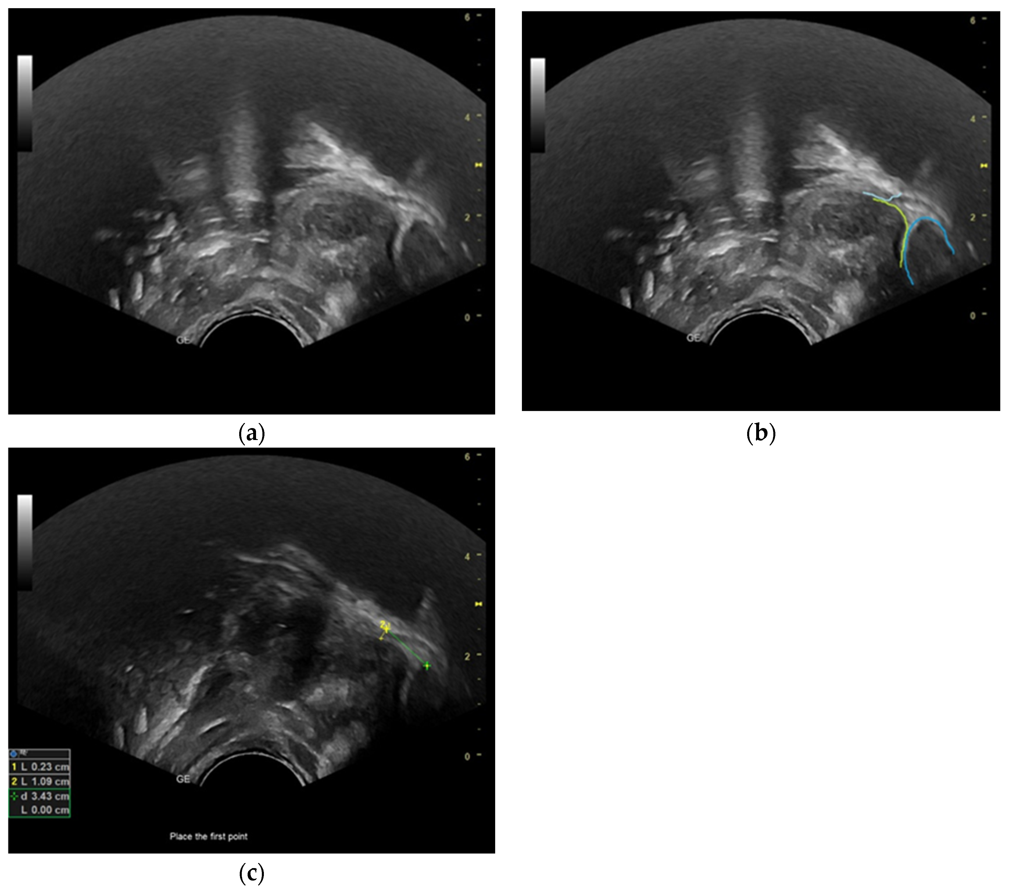 Diagnostics 13 03435 g001 Diagnostics 13 03435 g001
