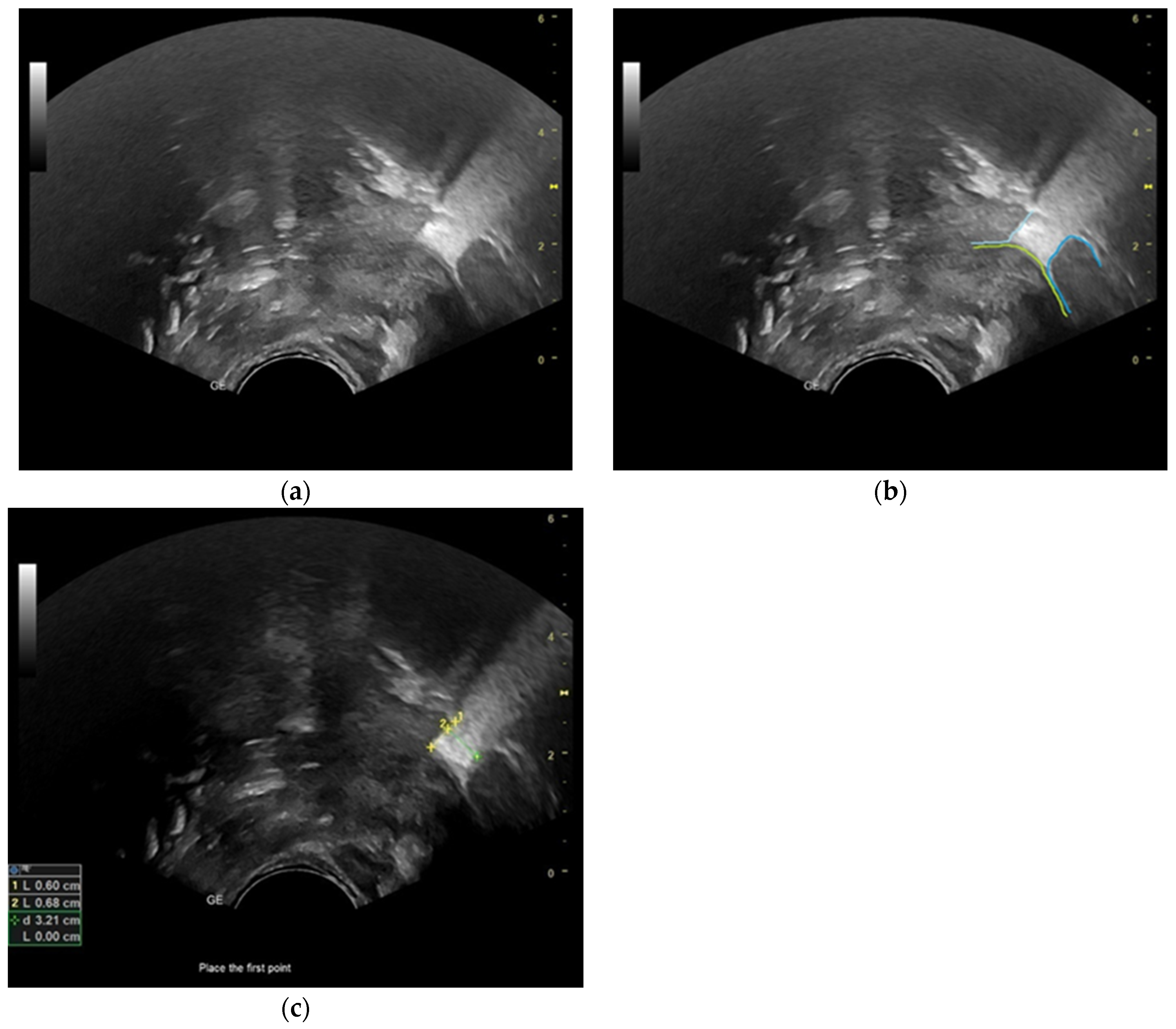 Diagnostics 13 03435 g002 Diagnostics 13 03435 g002