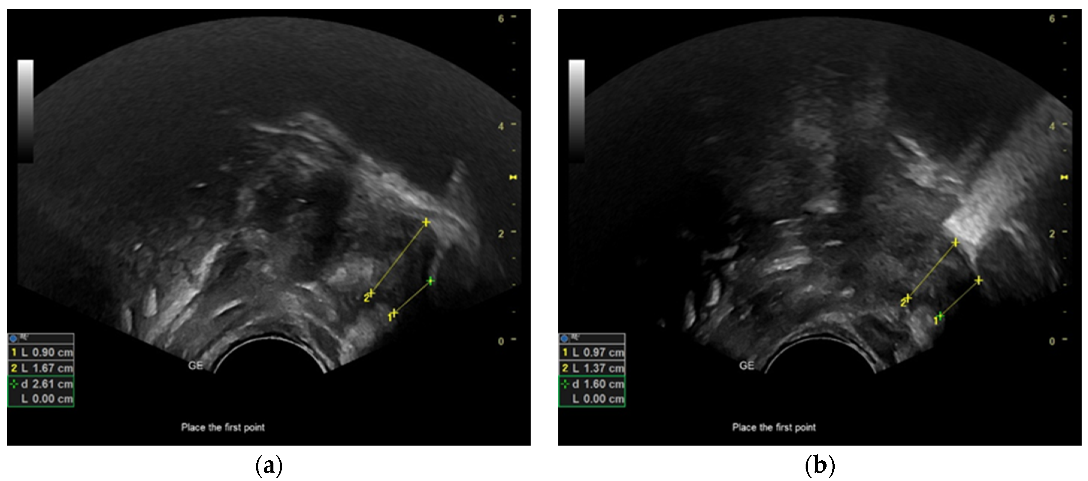 Diagnostics 13 03435 g003 Diagnostics 13 03435 g003
