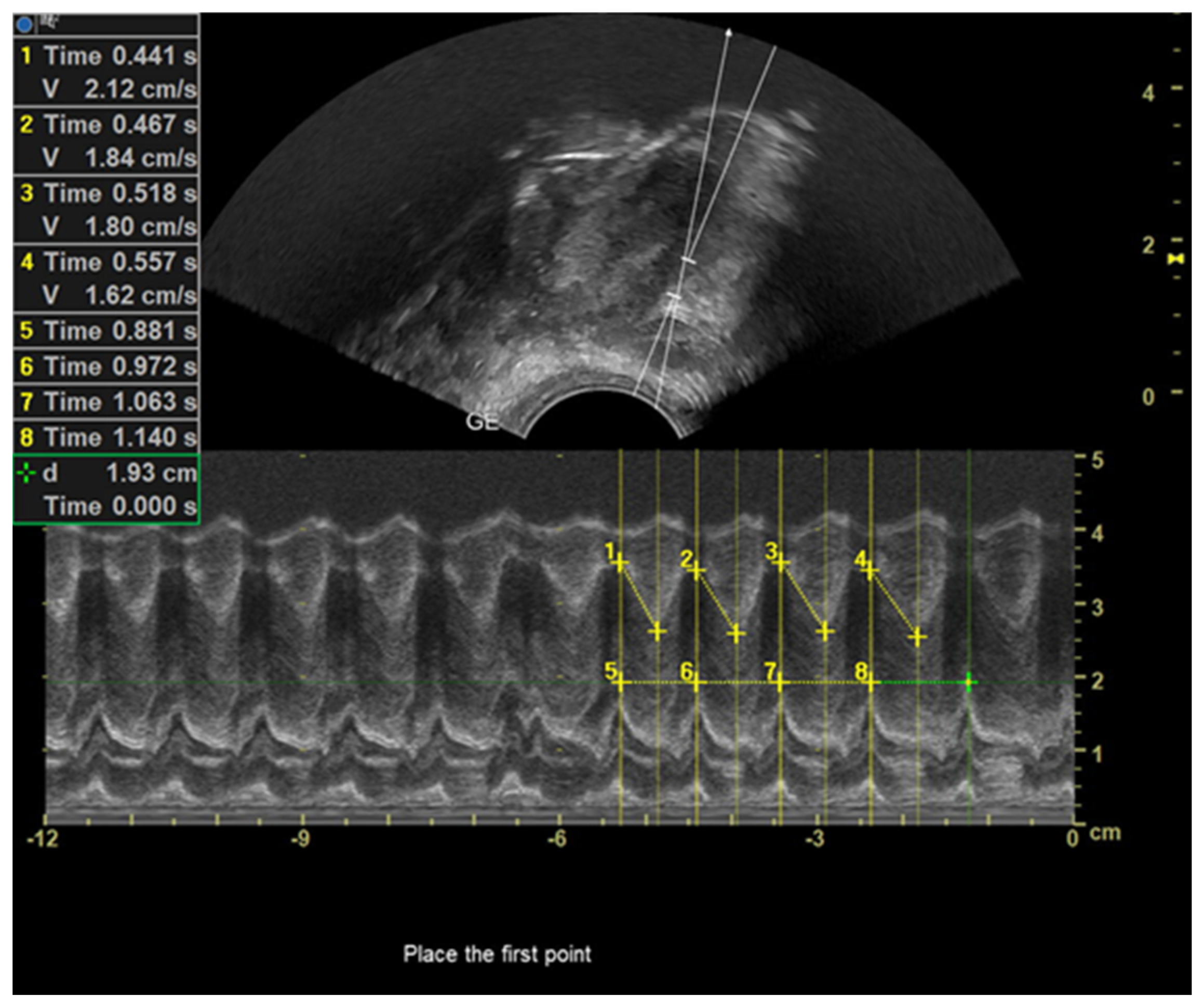 Diagnostics 13 03435 g005 Diagnostics 13 03435 g005