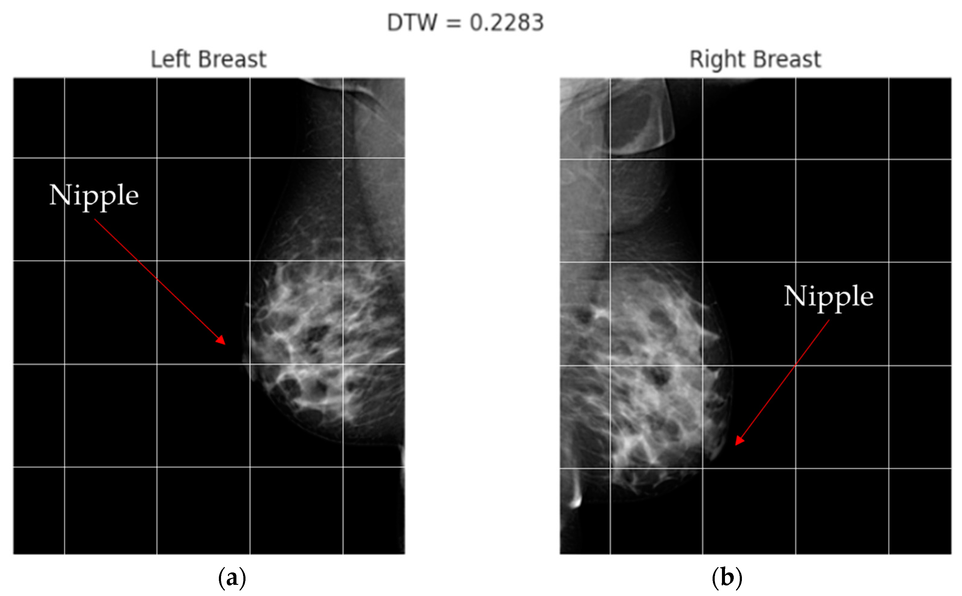 Diagnostics 13 03440 g007