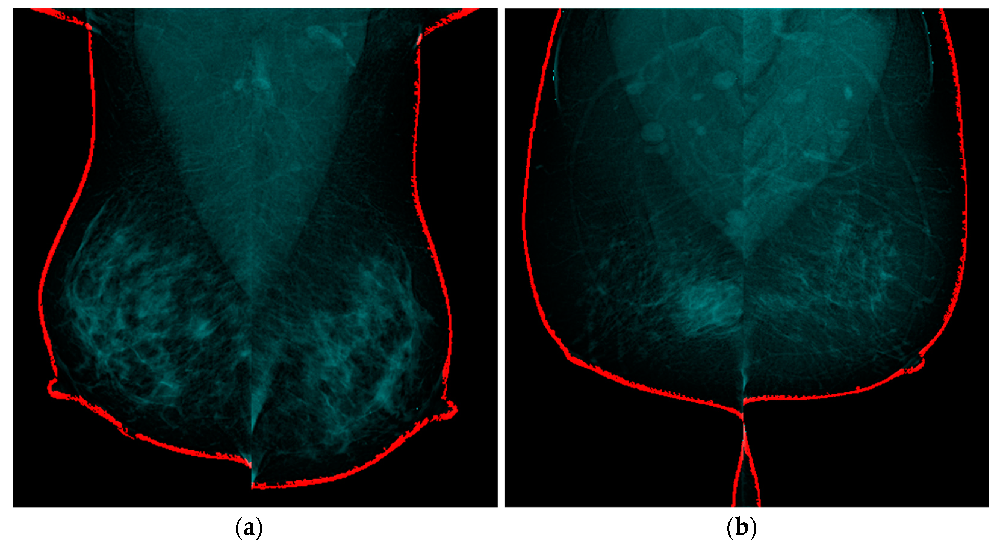 Diagnostics 13 03440 g014