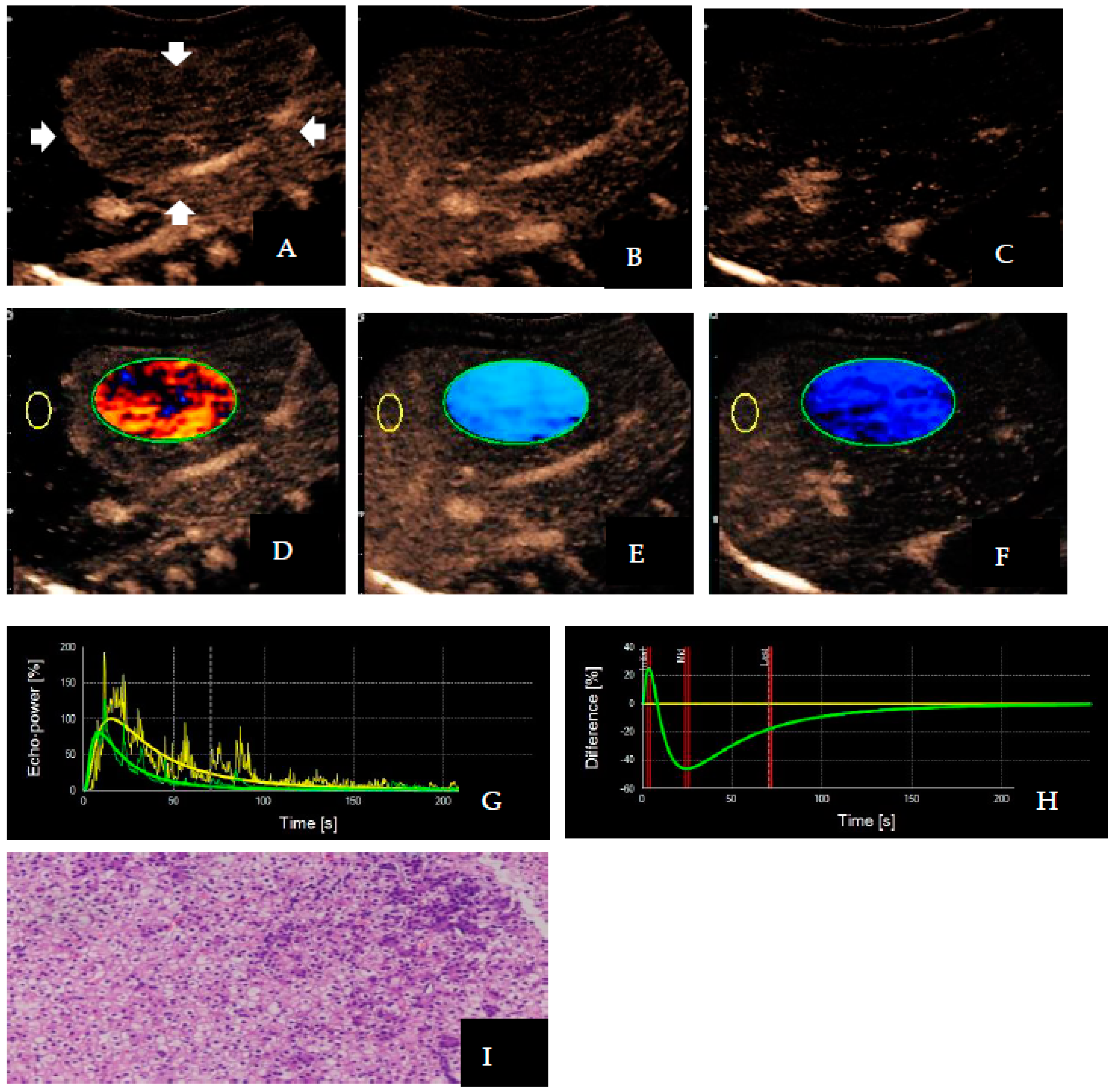 Diagnostics 13 03443 g003 Diagnostics 13 03443 g003