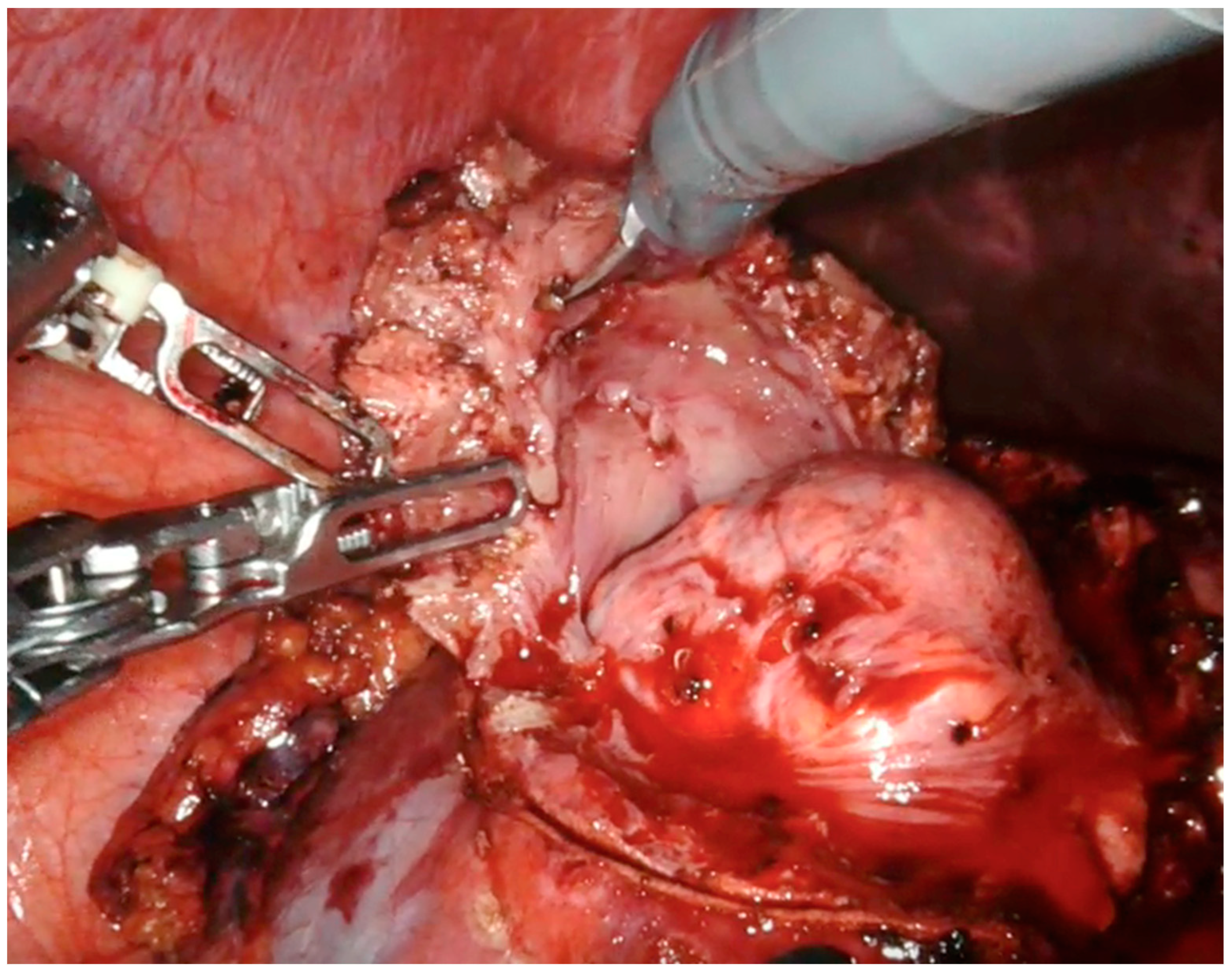 Diagnostics 13 03454 g004