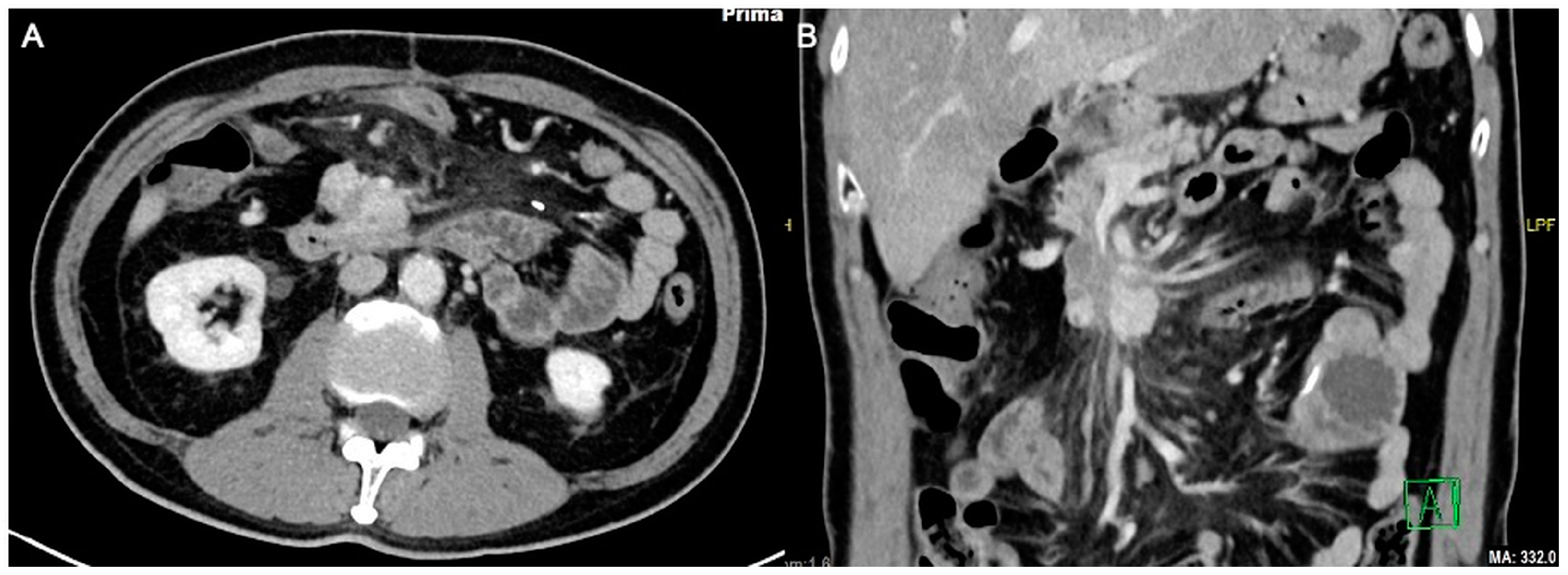 Diagnostics 13 03458 g004