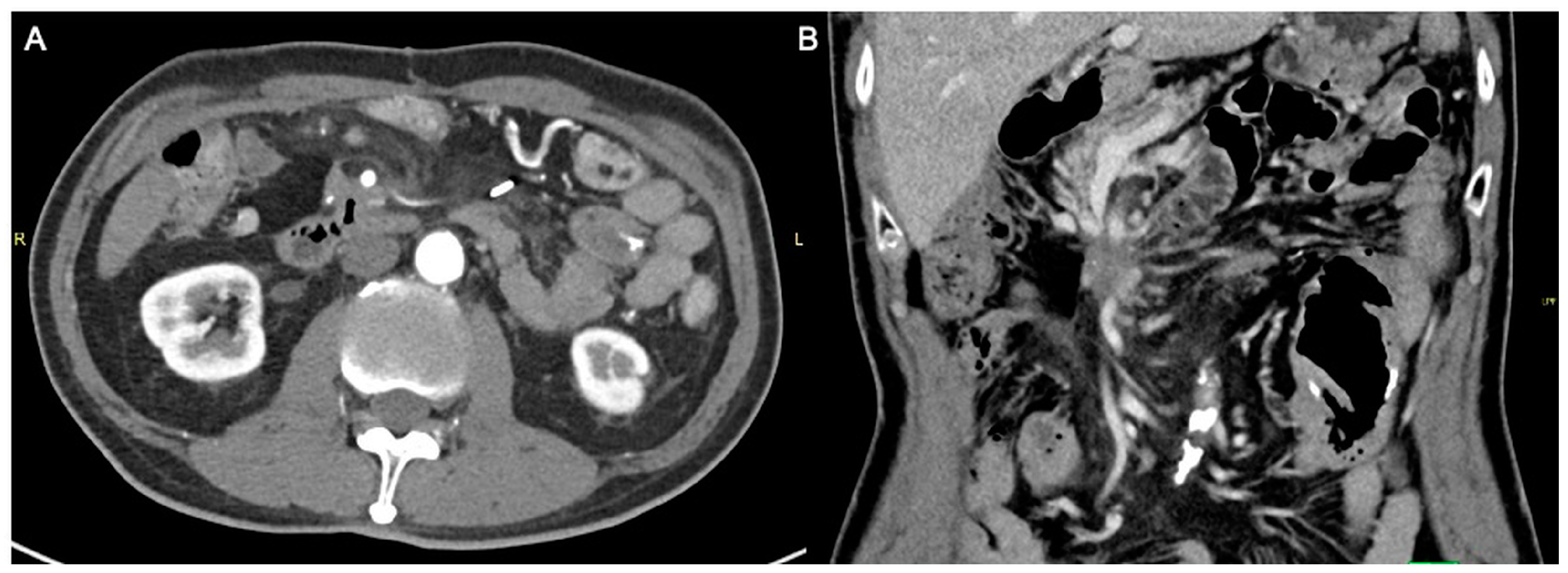 Diagnostics 13 03458 g006