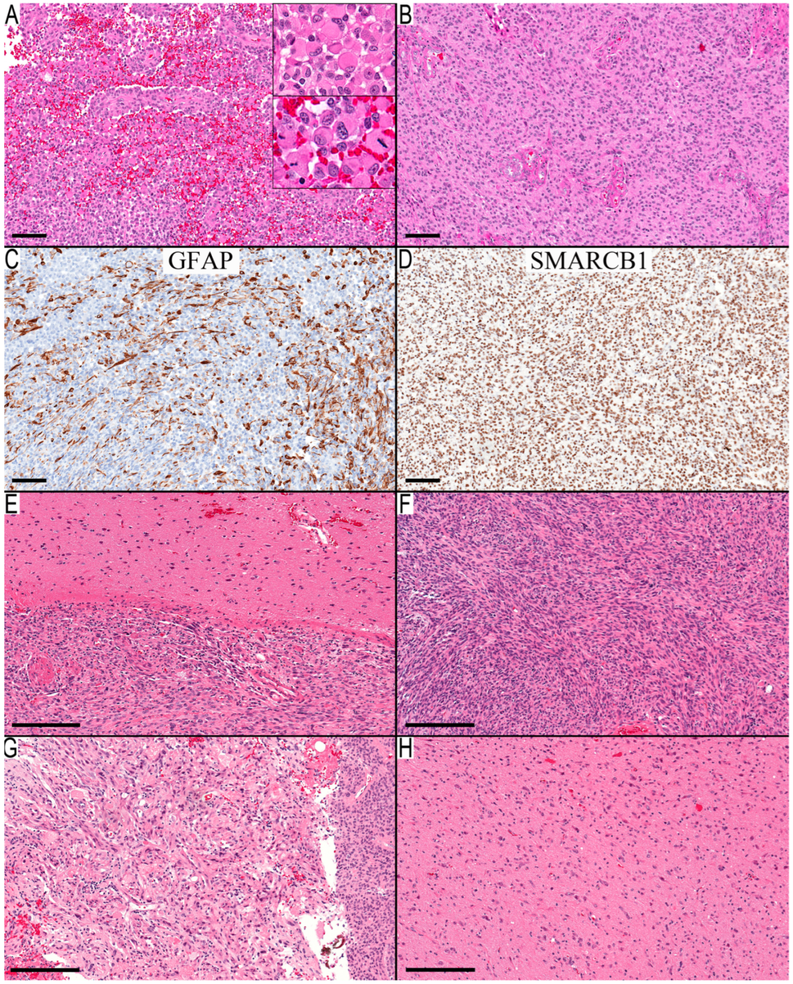 Diagnostics 13 03464 g003