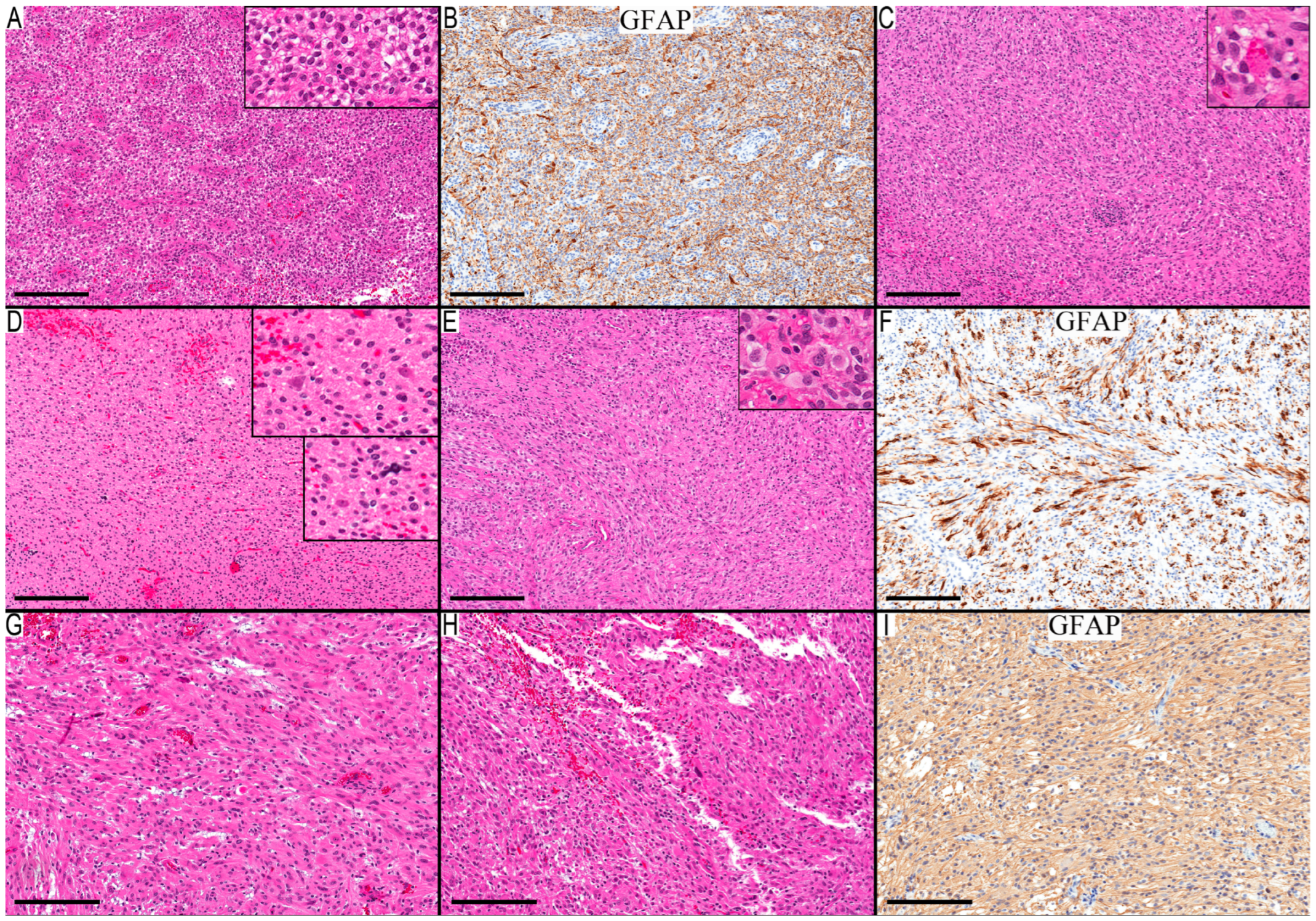 Diagnostics 13 03464 g004